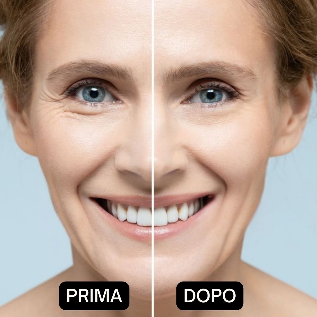 Confronto prima-dopo. Donna con rughe, poi pelle liscia. Sfondo blu.
