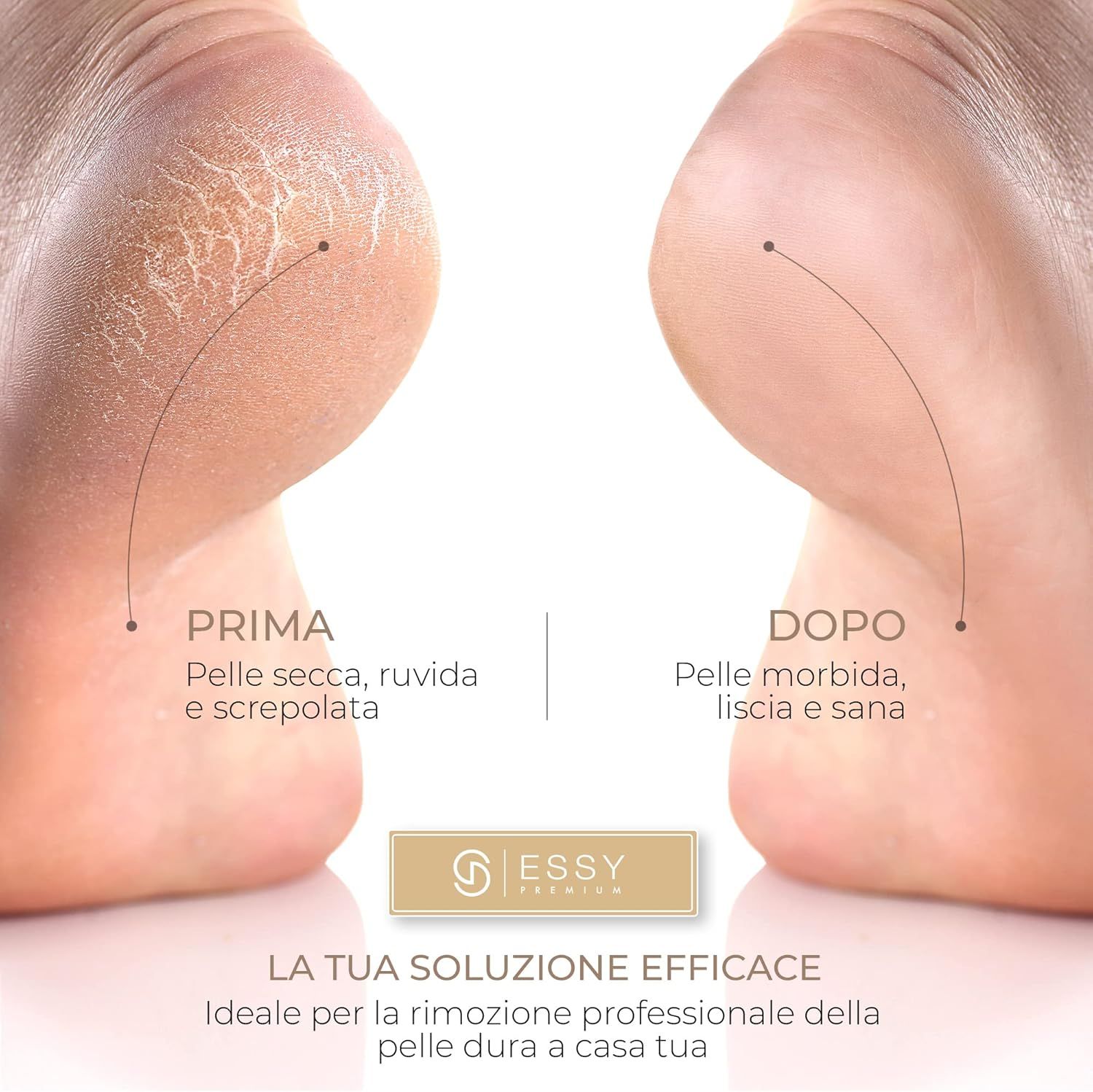 Rimuovi Calli Elettrico Essy con 5 Rulli di Ricambio – Bianco