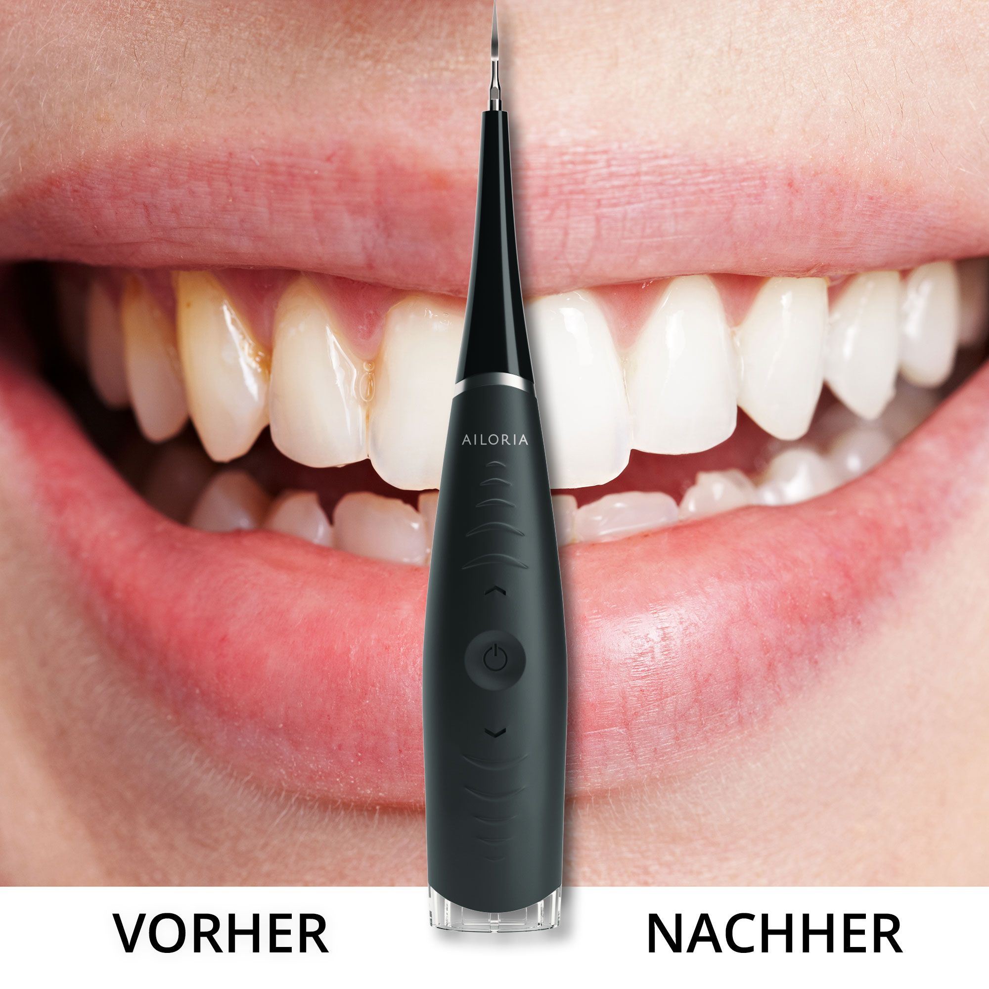 Confronto prima-dopo. Bocca con denti. Sinistra: denti macchiati. Destra: denti puliti. Pulitore dentale sonico.