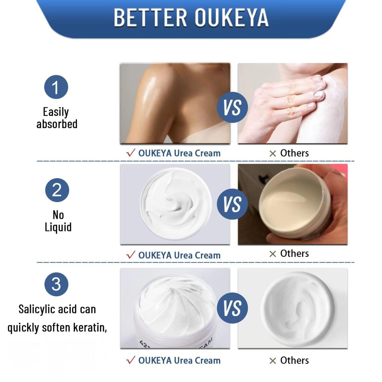 Immagini comparative: OUKEYA Crema Urea vs. altri prodotti. Mostra le differenze di assorbimento, consistenza ed effetto.