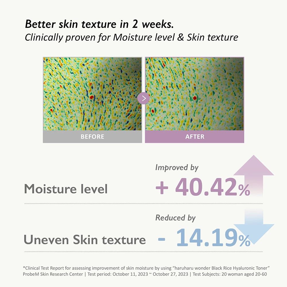 Confronto prima-dopo della texture della pelle. Idratazione migliorata del +40,42%, texture non uniforme ridotta del -14,19%.