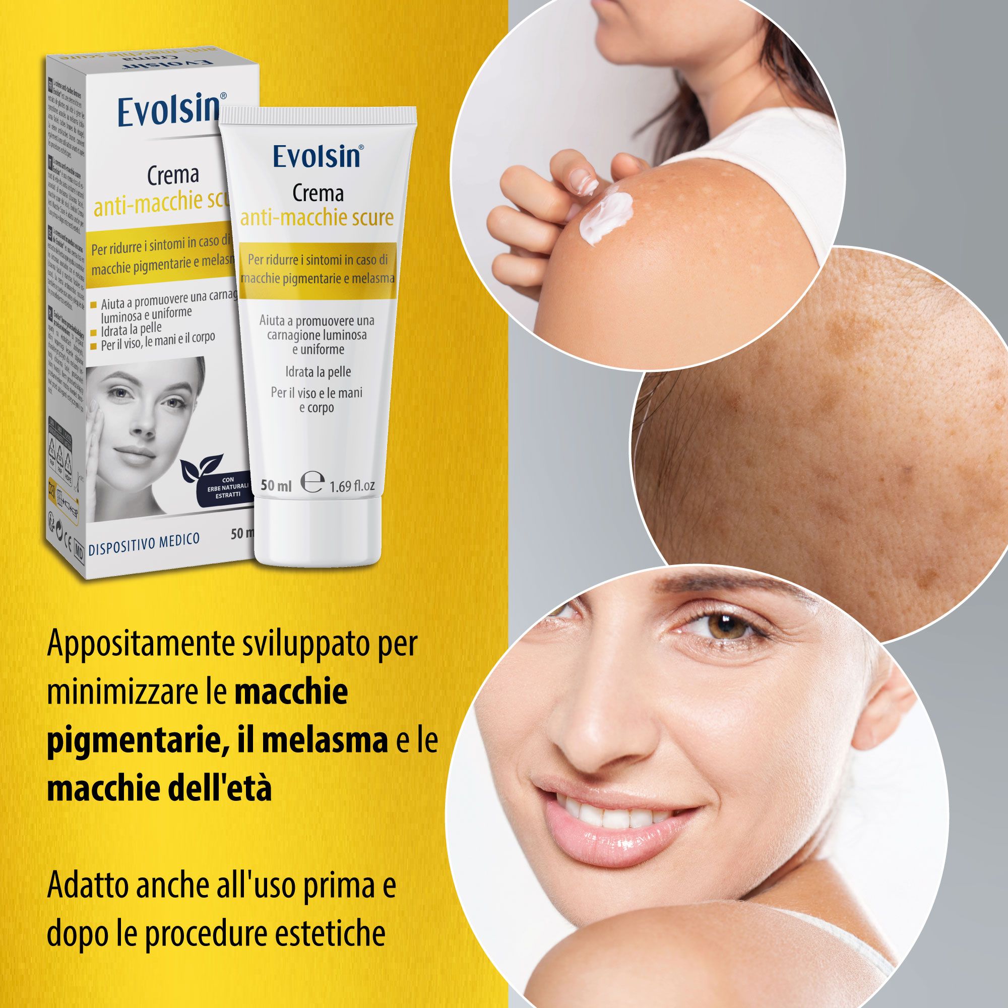 Donna con macchie pigmentarie. Testo: EVOLSIN® Crema anti-macchie scure. Per macchie pigmentarie, melasma e macchie dell'età.