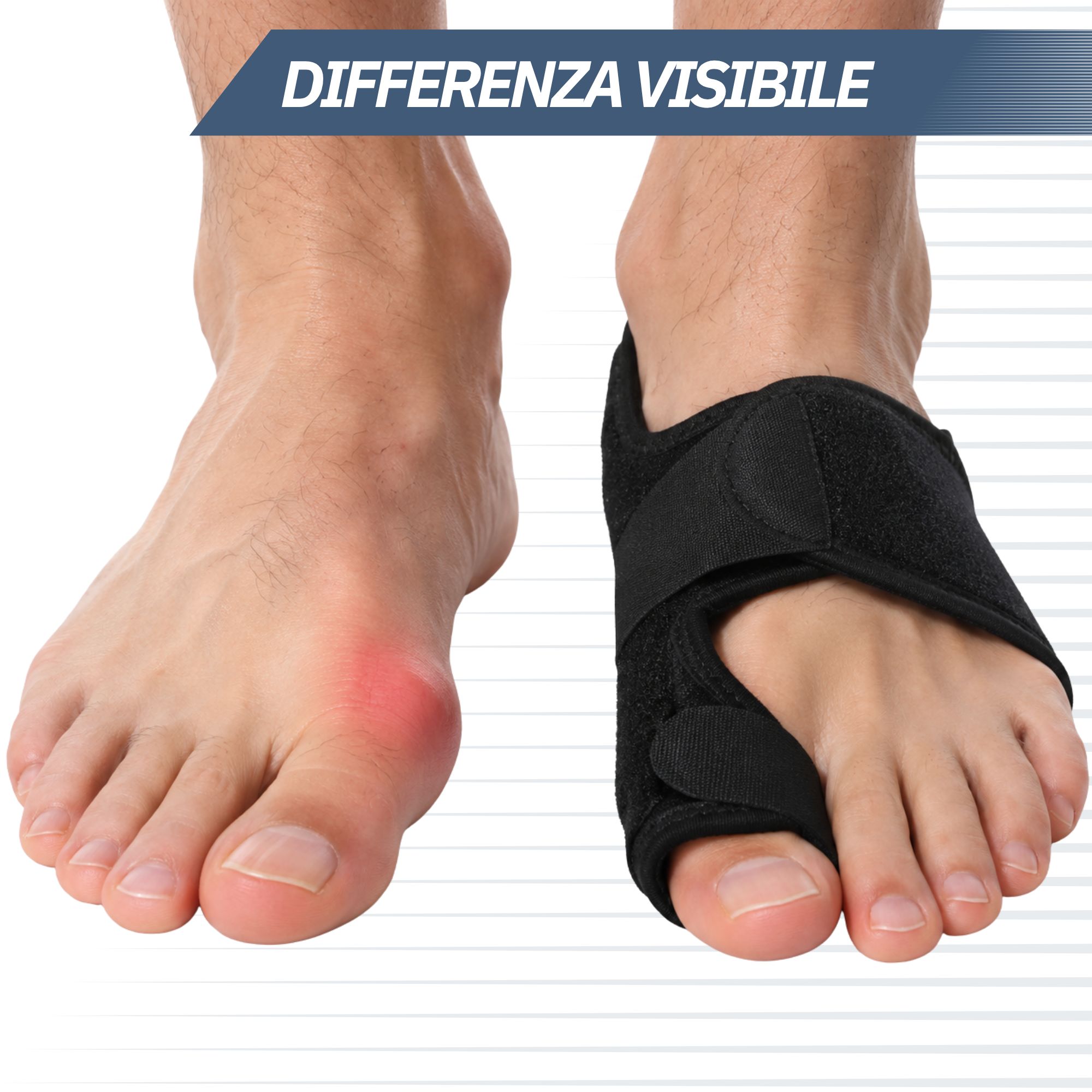 Protezione Hallux Valgus con stecche metalliche.
