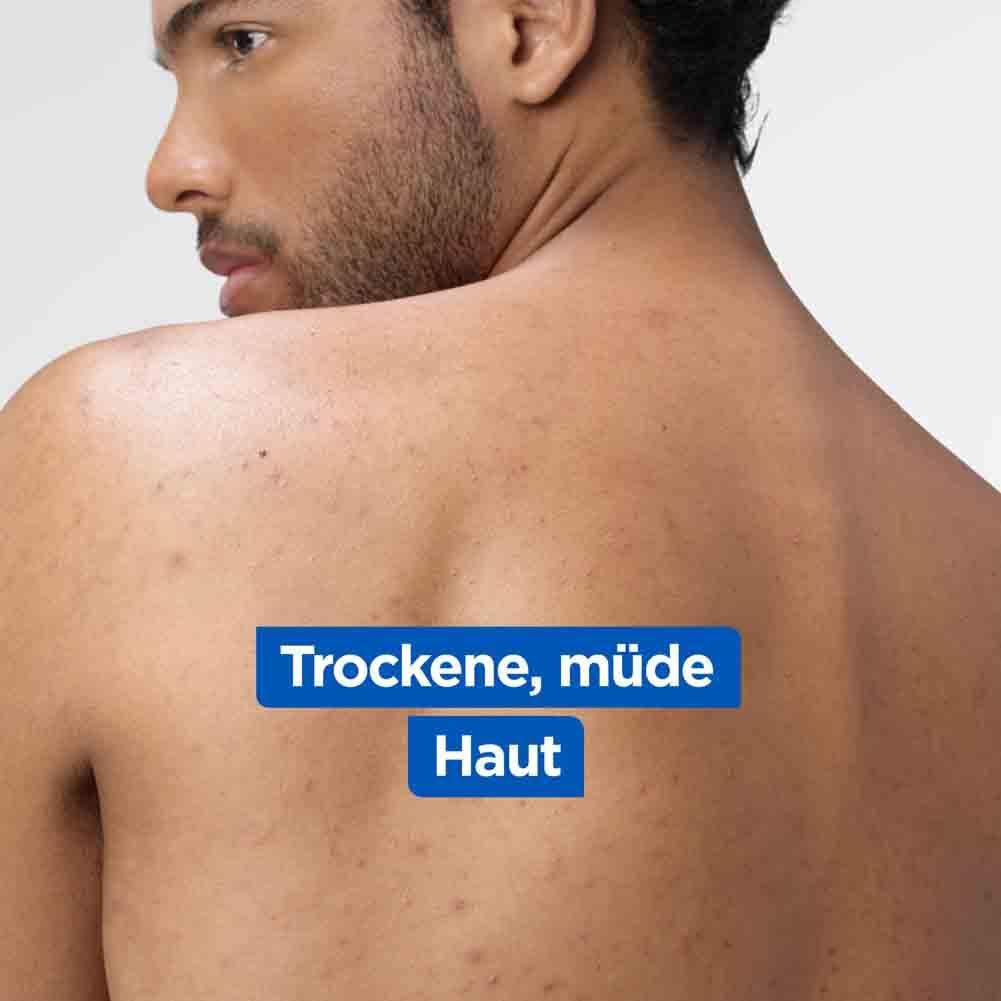 Schiena di una persona. Testo: Pelle secca e stanca.