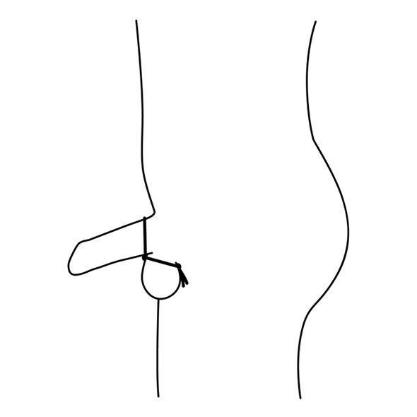 Rappresentazione schematica di un pene con un anello fallico. L'anello è posizionato attorno al pene.