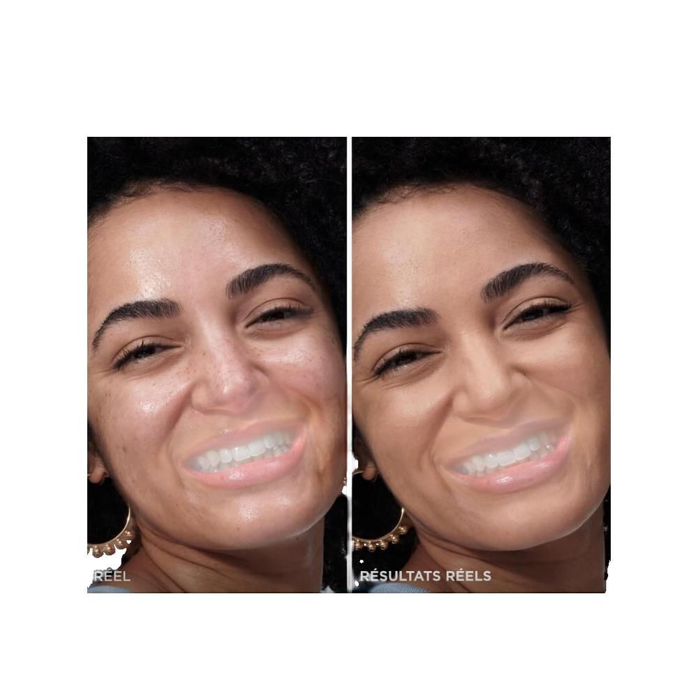 Due foto affiancate. A sinistra: viso con imperfezioni. A destra: viso con incarnato uniforme. Testo: Résultats Reels.