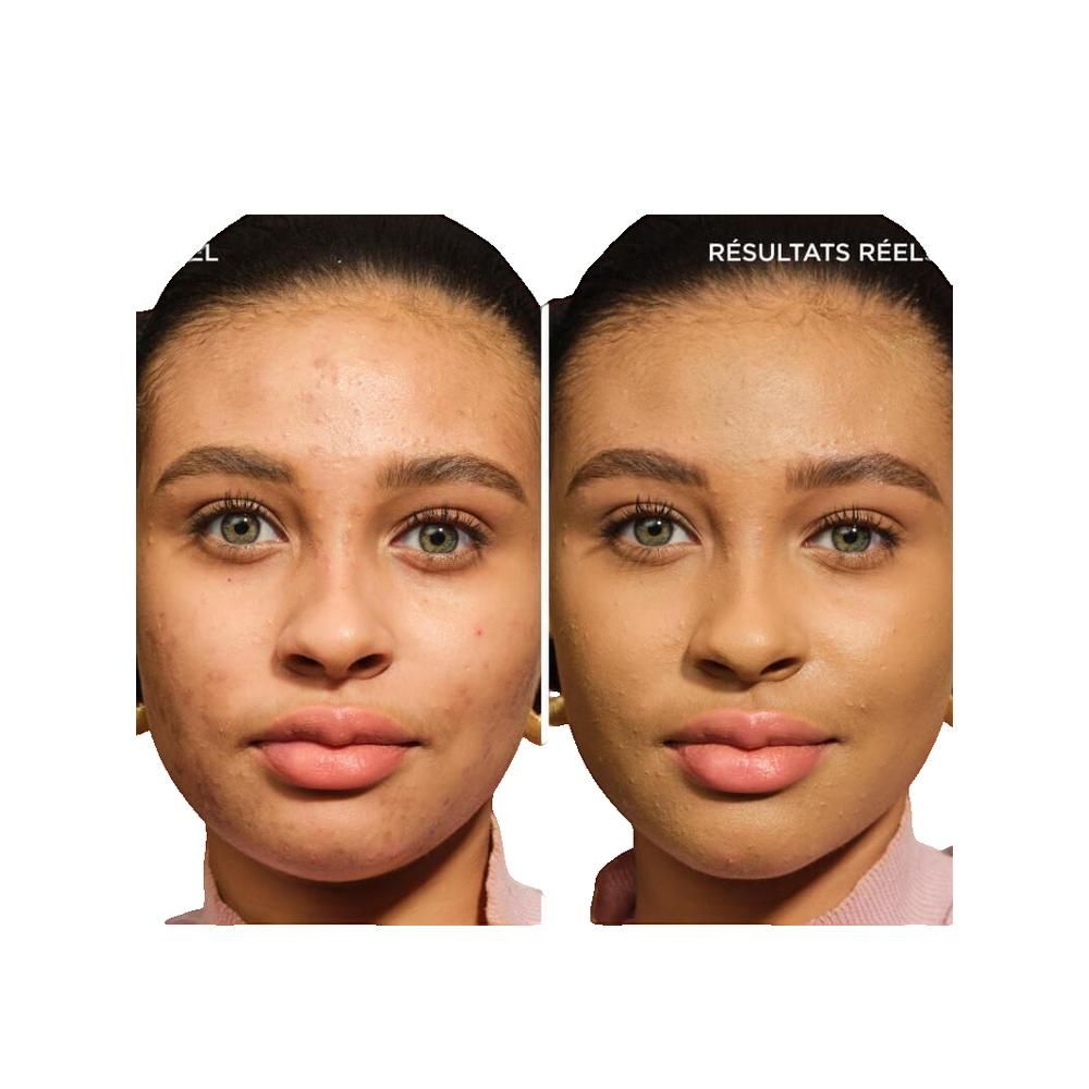 Confronto prima e dopo. Viso con imperfezioni, poi viso con incarnato uniforme. Testo: 'Résultats réel'.