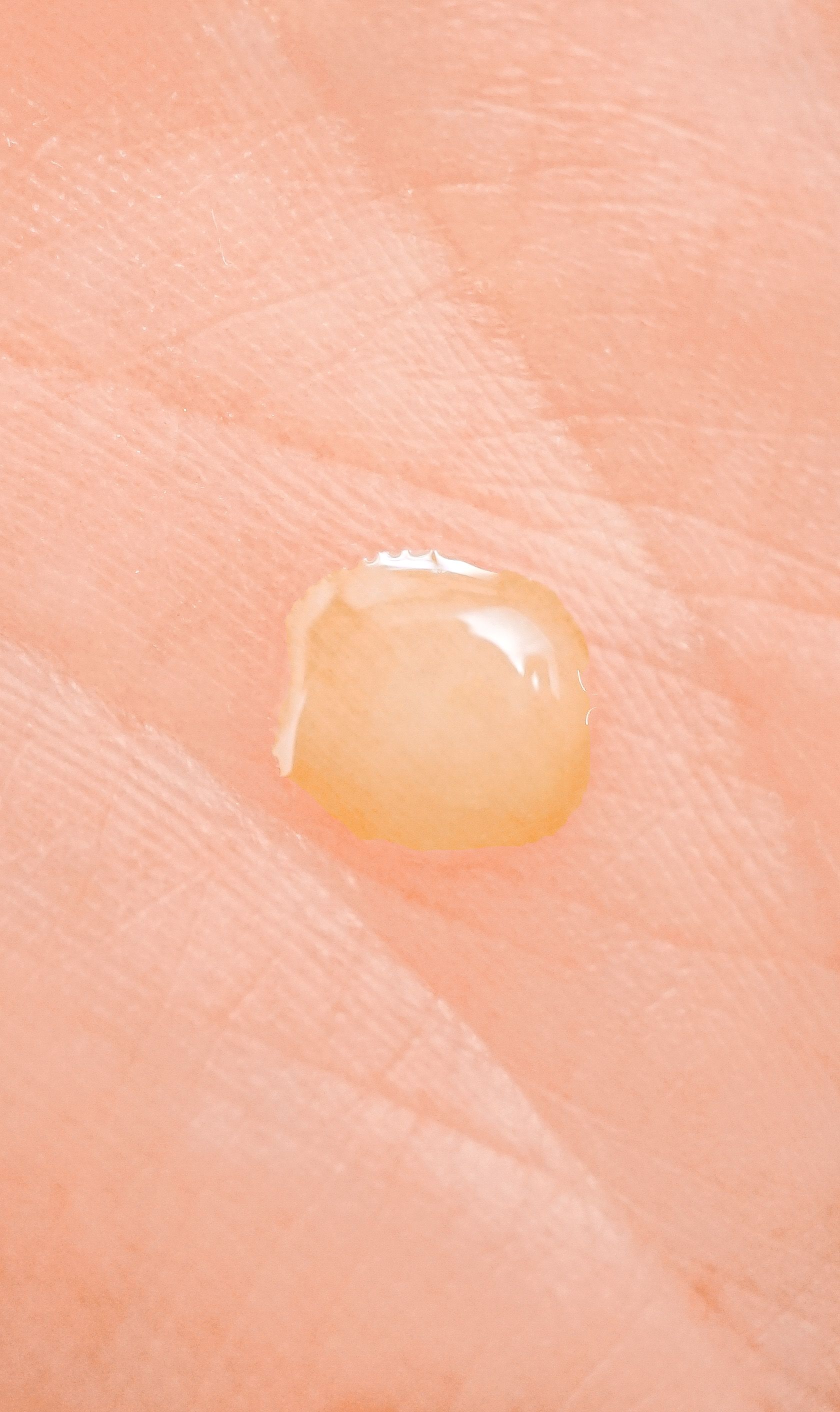 Goccia di liquido giallastro su un palmo. Il liquido è leggermente lucido e di forma irregolare.