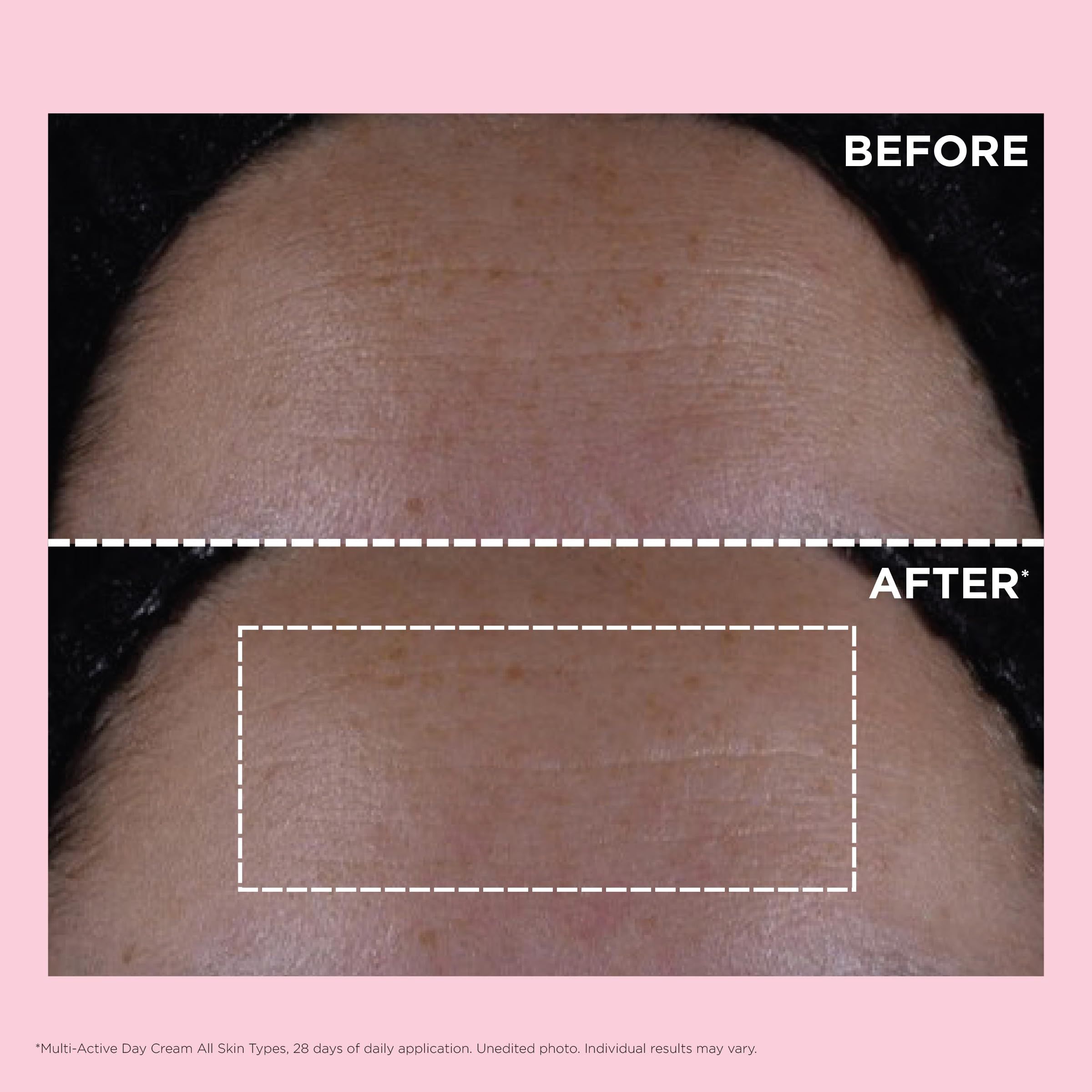 Confronto prima-dopo. Zona di pelle con rughe (prima) e pelle liscia (dopo). Testo: Multi-Active Day Cream All Skin Types.
