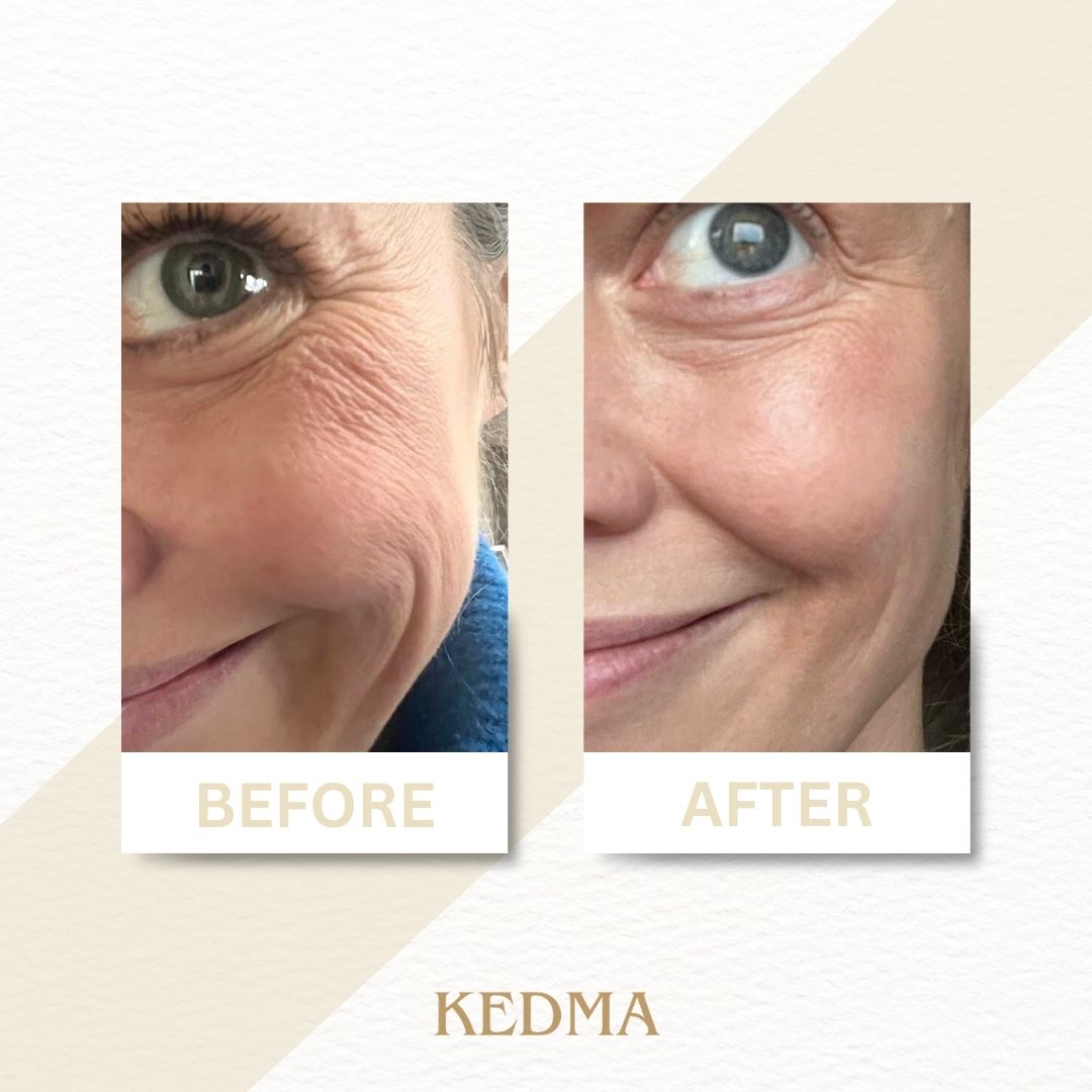 Kedma - Siero Anti-Età Platinum con Q10 e Multivitamine