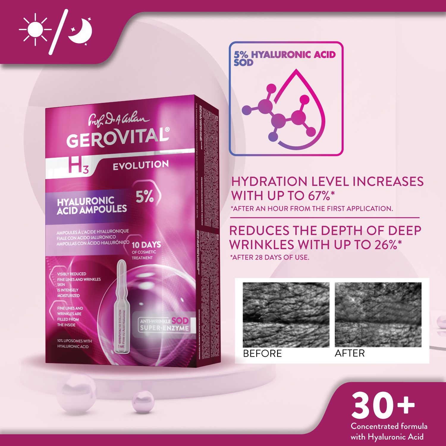 Confezione Gerovital con fiale. Testo: Fiale acido ialuronico 5%. L'idratazione aumenta. Riduce le rughe profonde. Foto prima/dopo.
