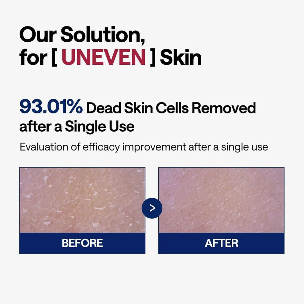 Confronto prima-dopo. Testo: "93.01% Dead Skin Cells Removed". Due immagini della pelle, prima e dopo l'uso.