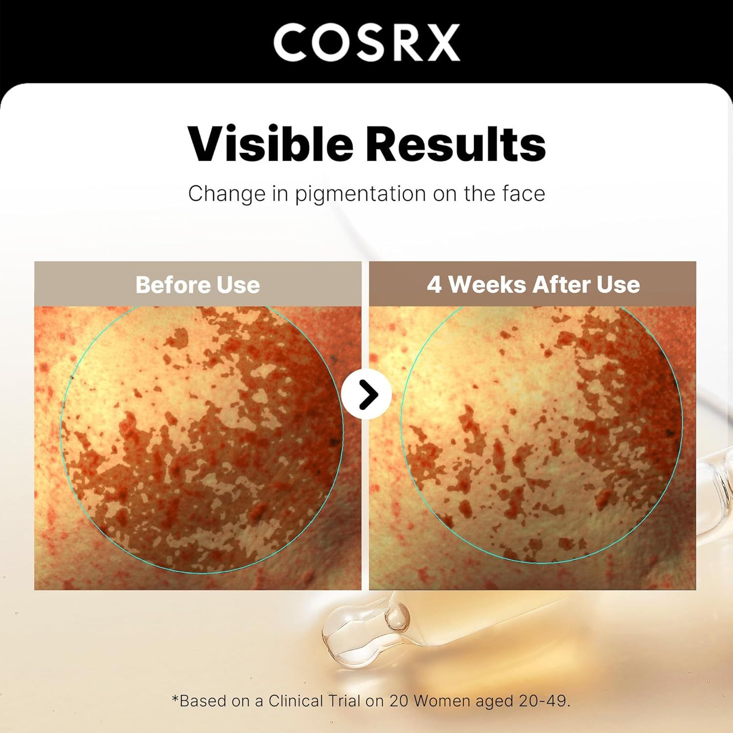 Confronto della pelle prima e dopo 4 settimane di utilizzo. Cambiamento di pigmentazione visibile. Marchio COSRX.