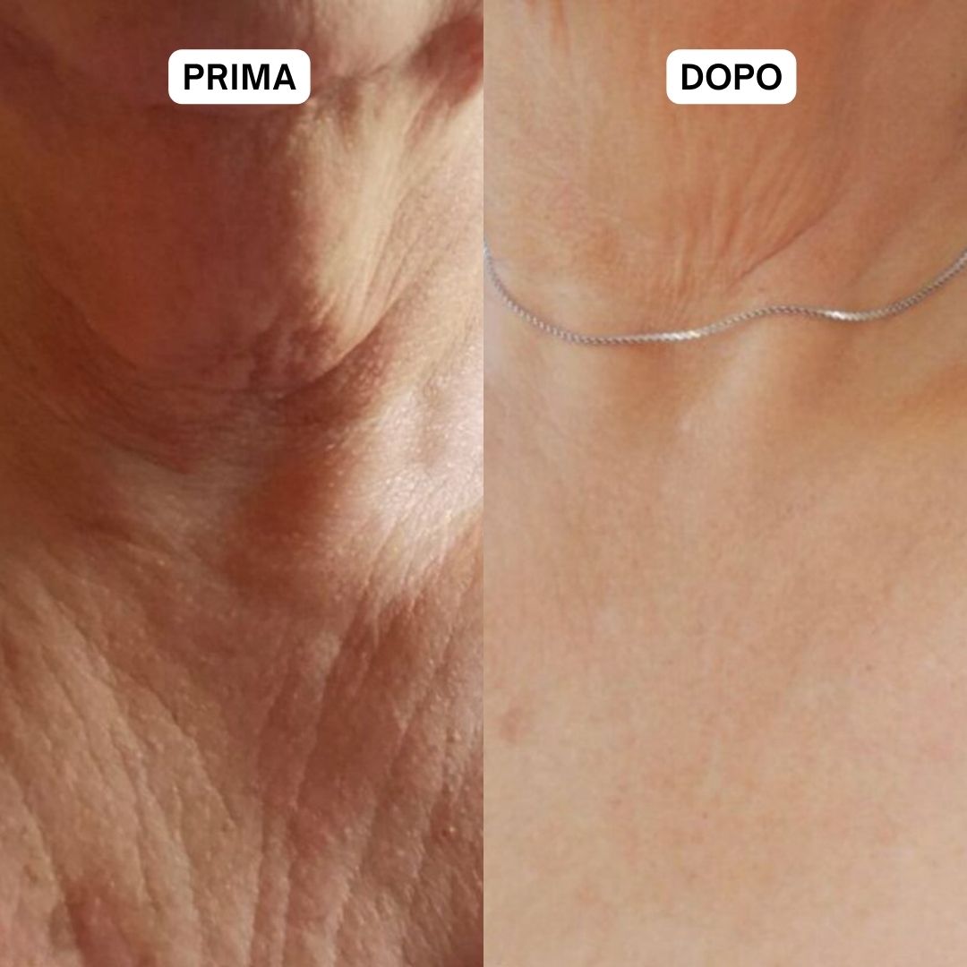 Confronto prima-dopo del collo. A sinistra: pelle rugosa. A destra: pelle più liscia.