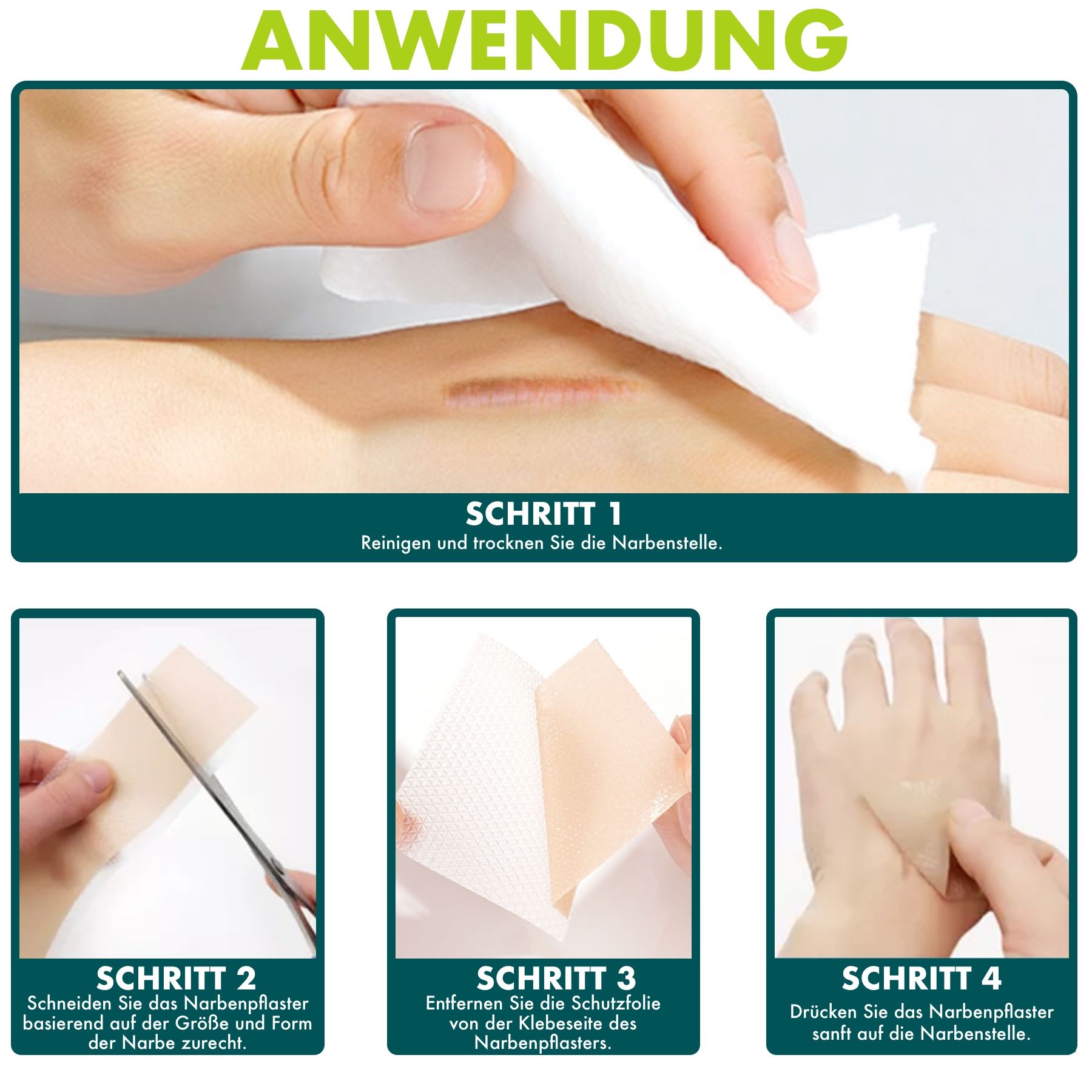 Fasi di applicazione dei cerotti in silicone. Pulizia, asciugatura, taglio, rimozione della pellicola protettiva, incollaggio.