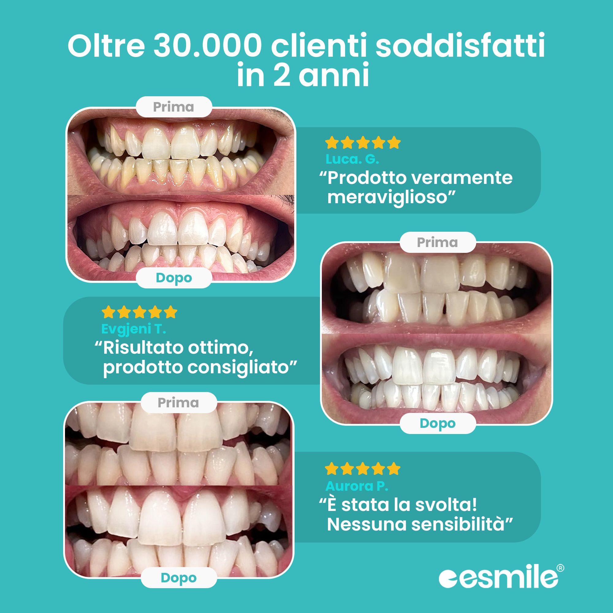 esmile - Kit Sbiancante Denti Professionale 16 Led