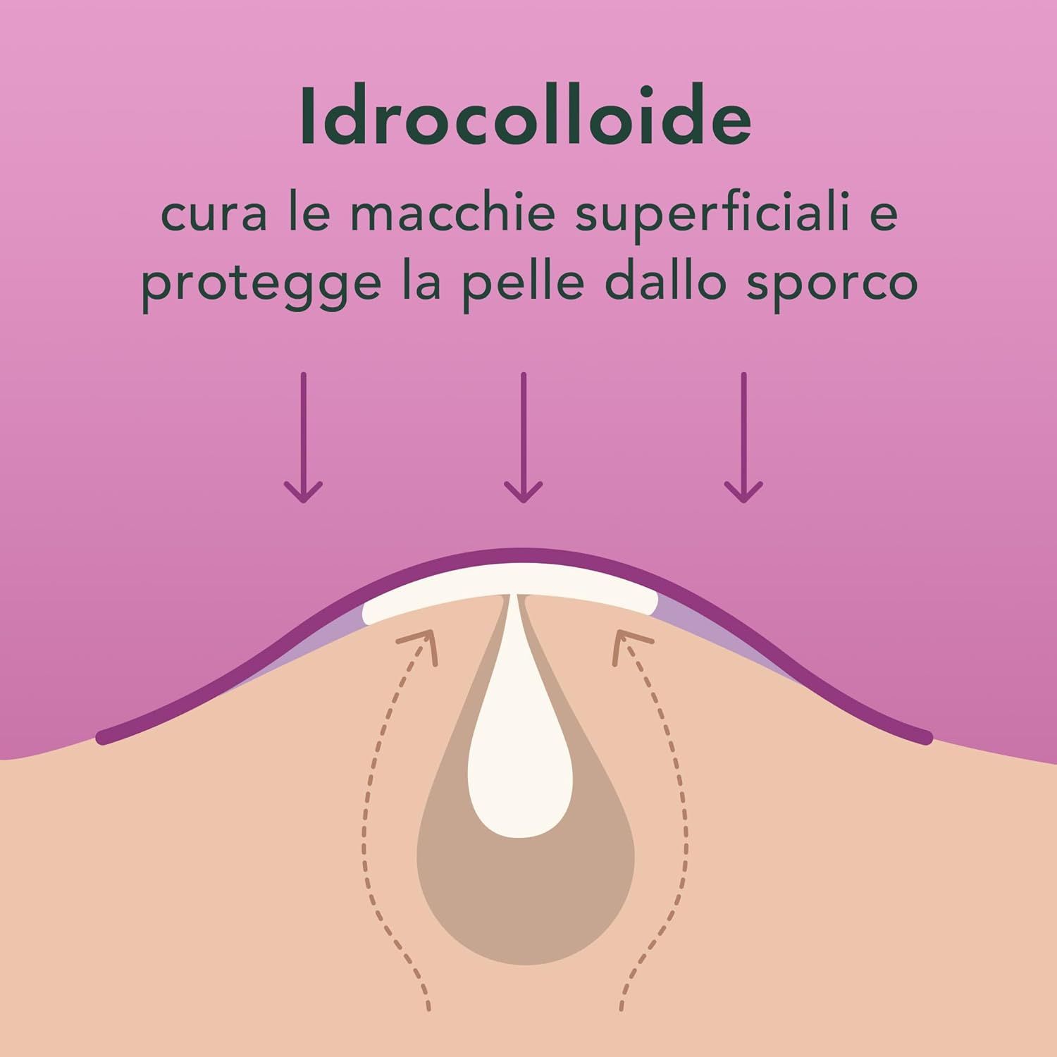 Illustrazione di un'eruzione cutanea. Le frecce puntano alla pelle. Testo: Idrocolloide. Combatte le discromie e protegge la pelle.