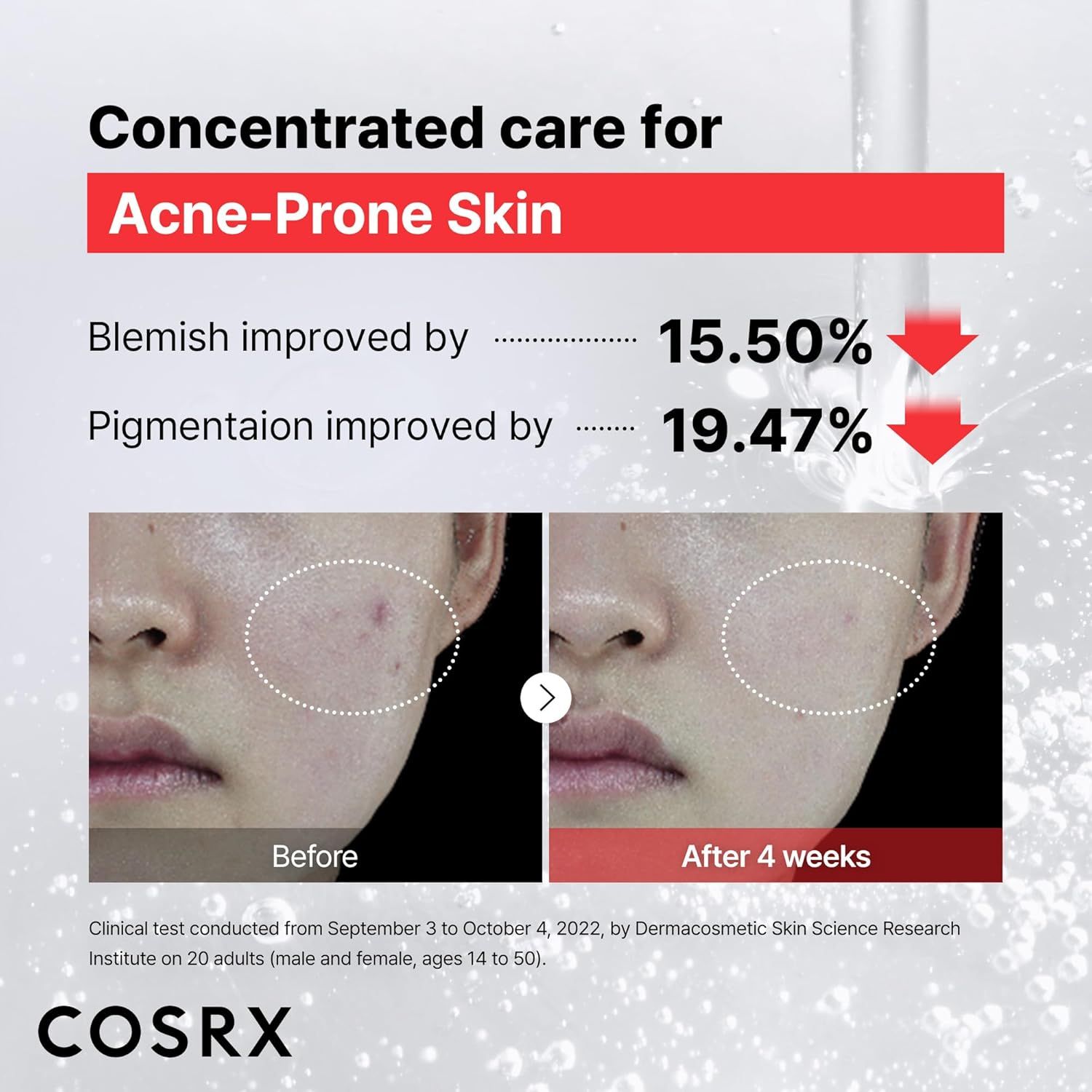 Flacone di siero COSRX Niacinamide 15 con contagocce. Contiene Acetil Glucosamina + Zinco PCA.