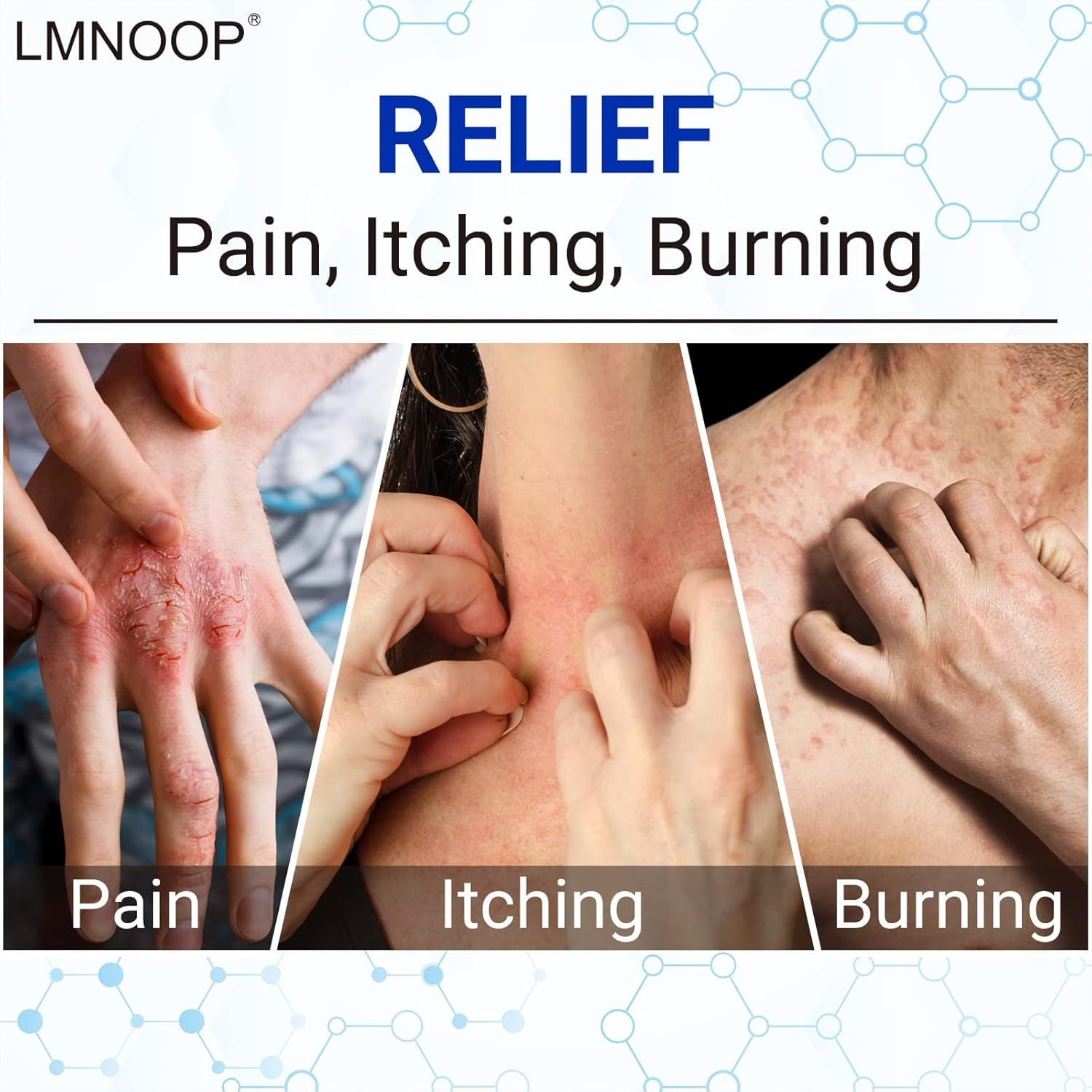 LMNOOP crema per eczema