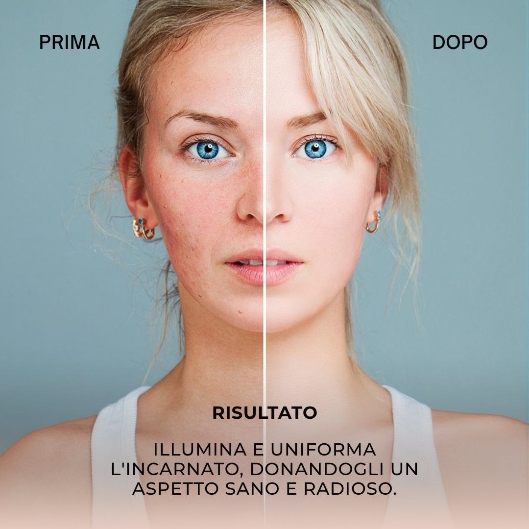 Immagine prima-dopo. Viso con imperfezioni, poi pelle liscia. Testo: Risultato: Illumina e uniforma l'incarnato.
