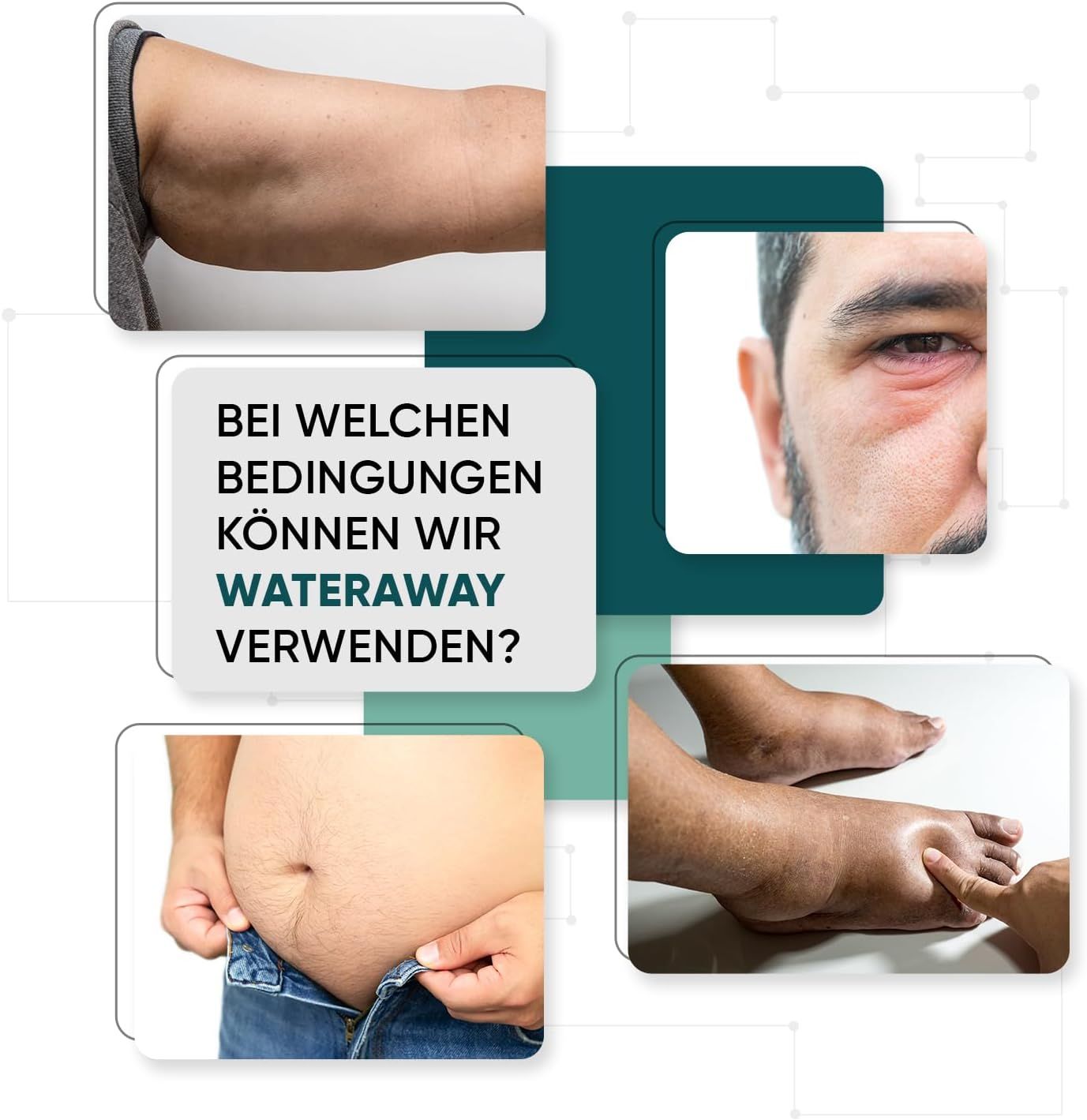 Immagini di condizioni: braccio, viso, pancia, gamba. Testo: In quali condizioni possiamo usare Water Away?