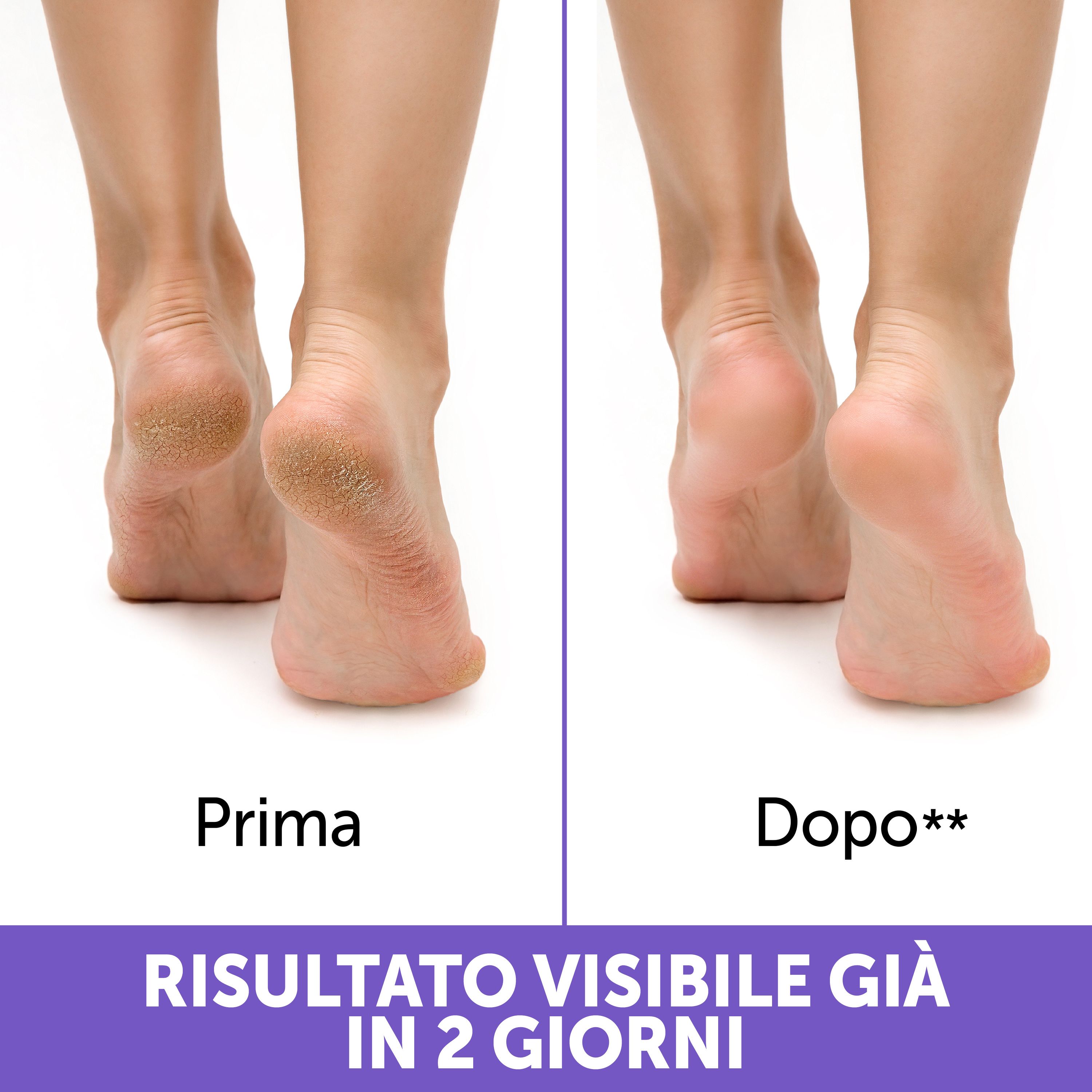 Podovis Crema Rigenera Talloni Screpolati – 75 ml, risultati in 2 giorni