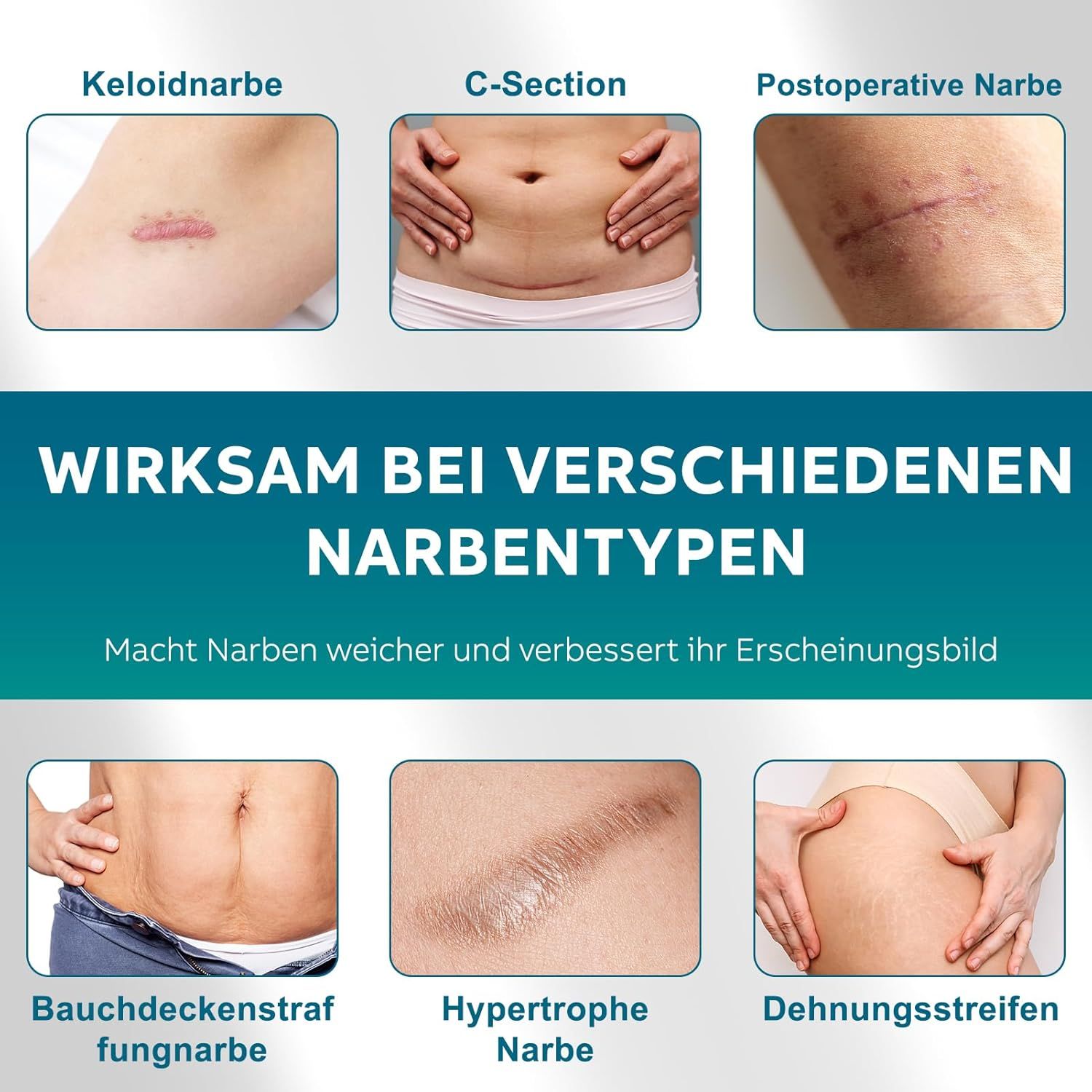 Nota: Applicare solo su pelle completamente guarita. Aumentare gradualmente la durata. I cambiamenti visibili richiedono tempo.