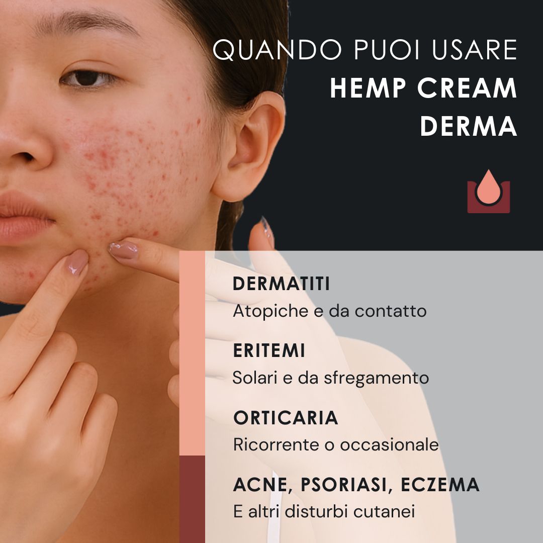 Donna che si tocca il viso. Testo: Quando puoi usare HEMP CREAM DERMA? Testo: Dermatite, Eritemi, Orticaria, Acne, Psoriasi, Eczema.