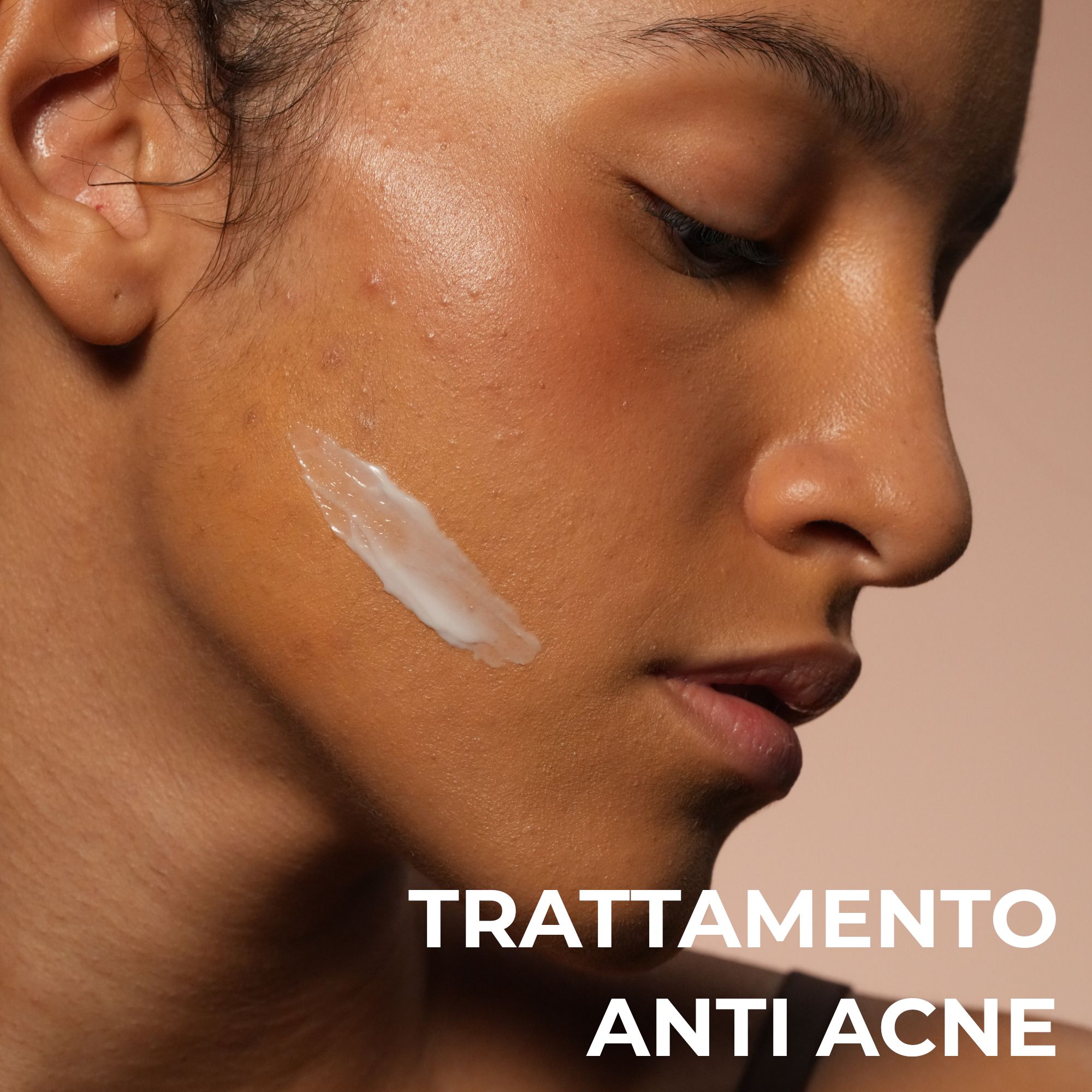Alkemy Crema Brufoli Viso, Trattamento anti Acne Riduce Brufoli, Imperfezioni, Rossori