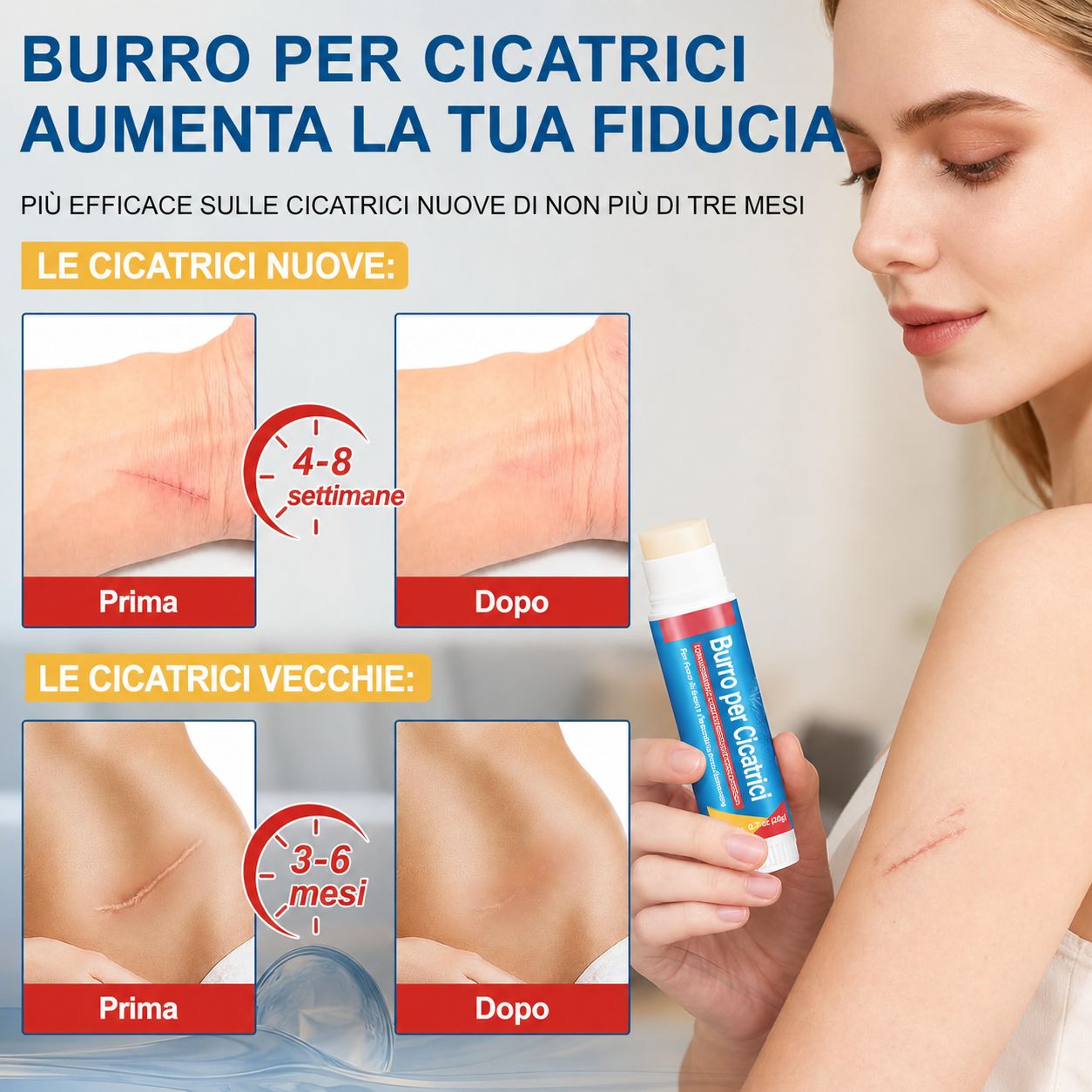 Donna con stick "Burro per Cicatrici". Immagini prima/dopo cicatrici. Durate per cicatrici nuove e vecchie.