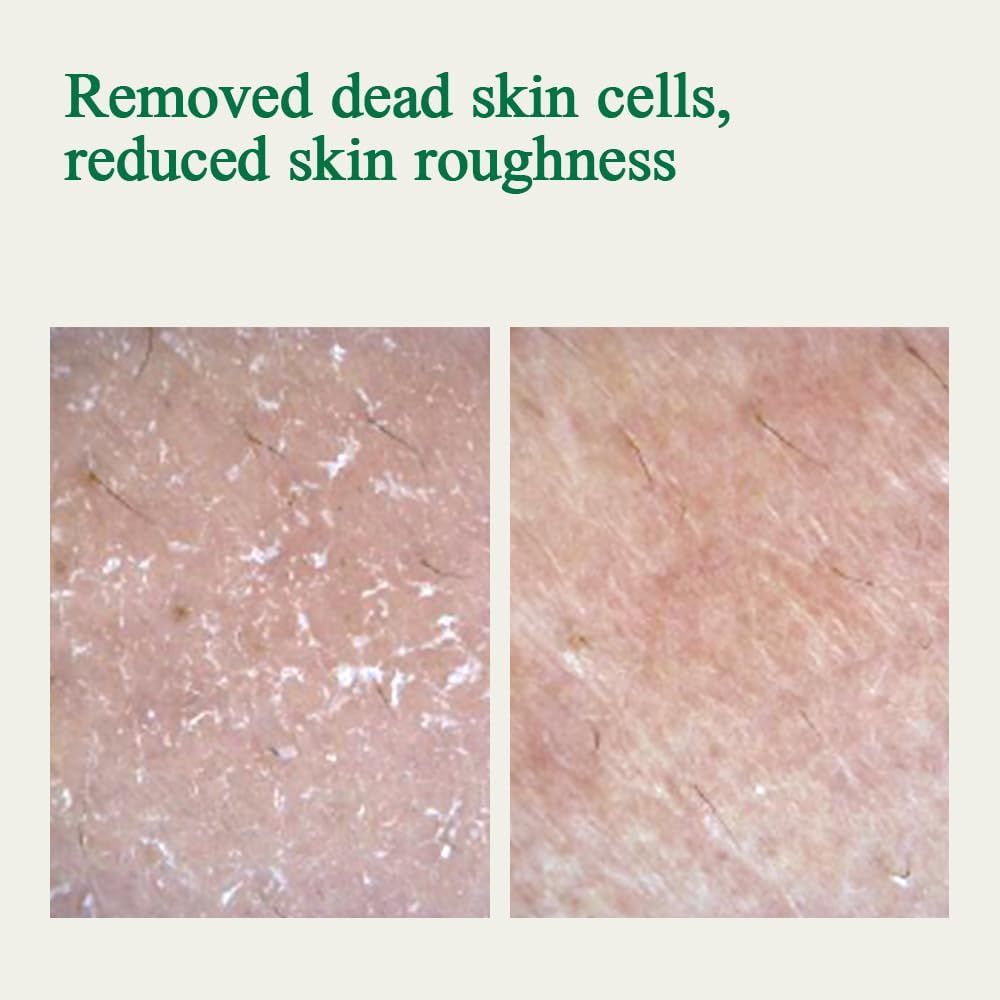 Due primi piani di superfici cutanee. Testo: Rimuove le cellule morte, riduce la ruvidità della pelle.