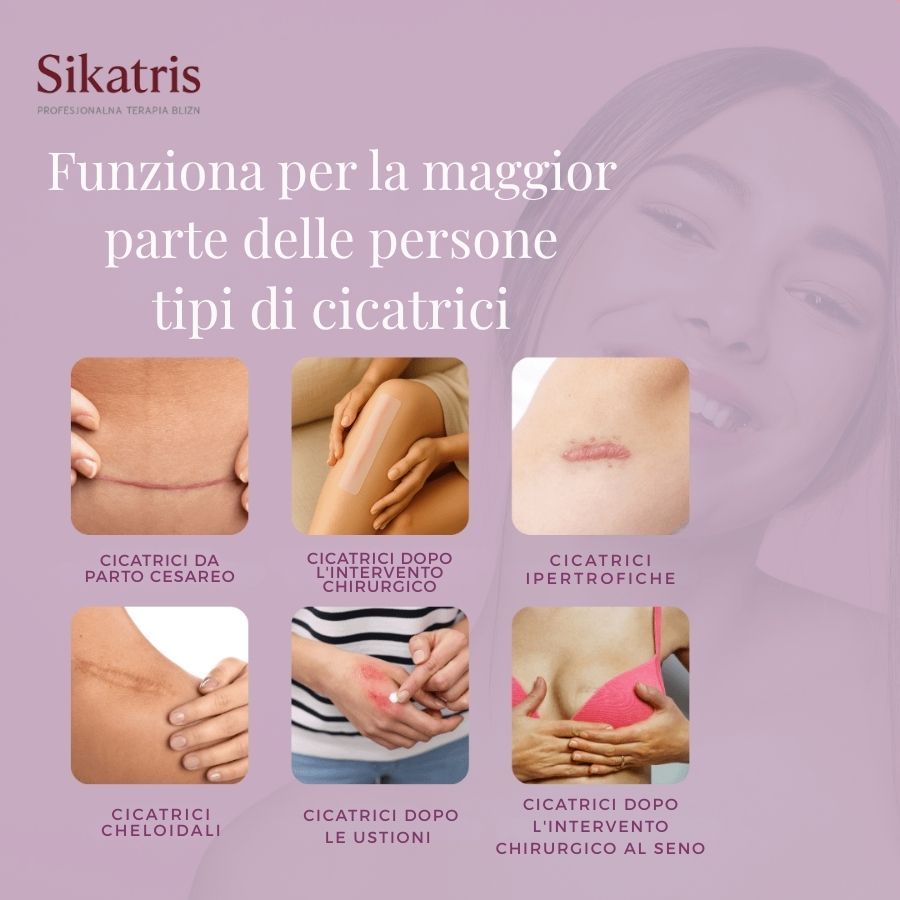 Collage di immagini di cicatrici su diverse parti del corpo. Testo: 'Funziona per la maggior parte delle persone tipi di cicatrici'.