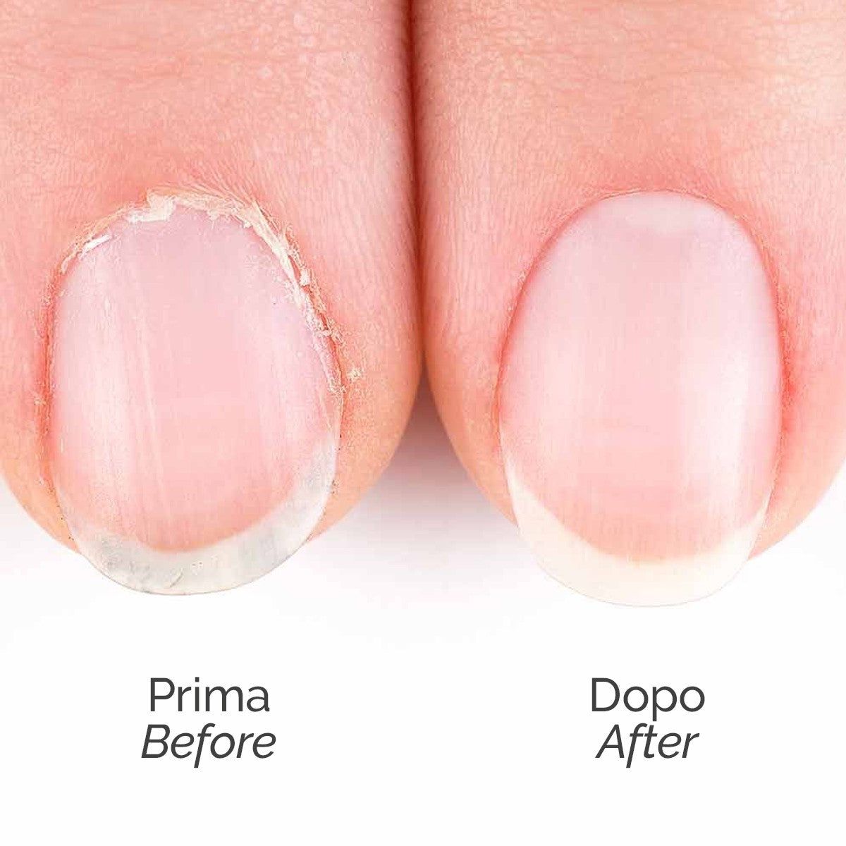 LCI Cosmetics - AHA Cuticle Remover