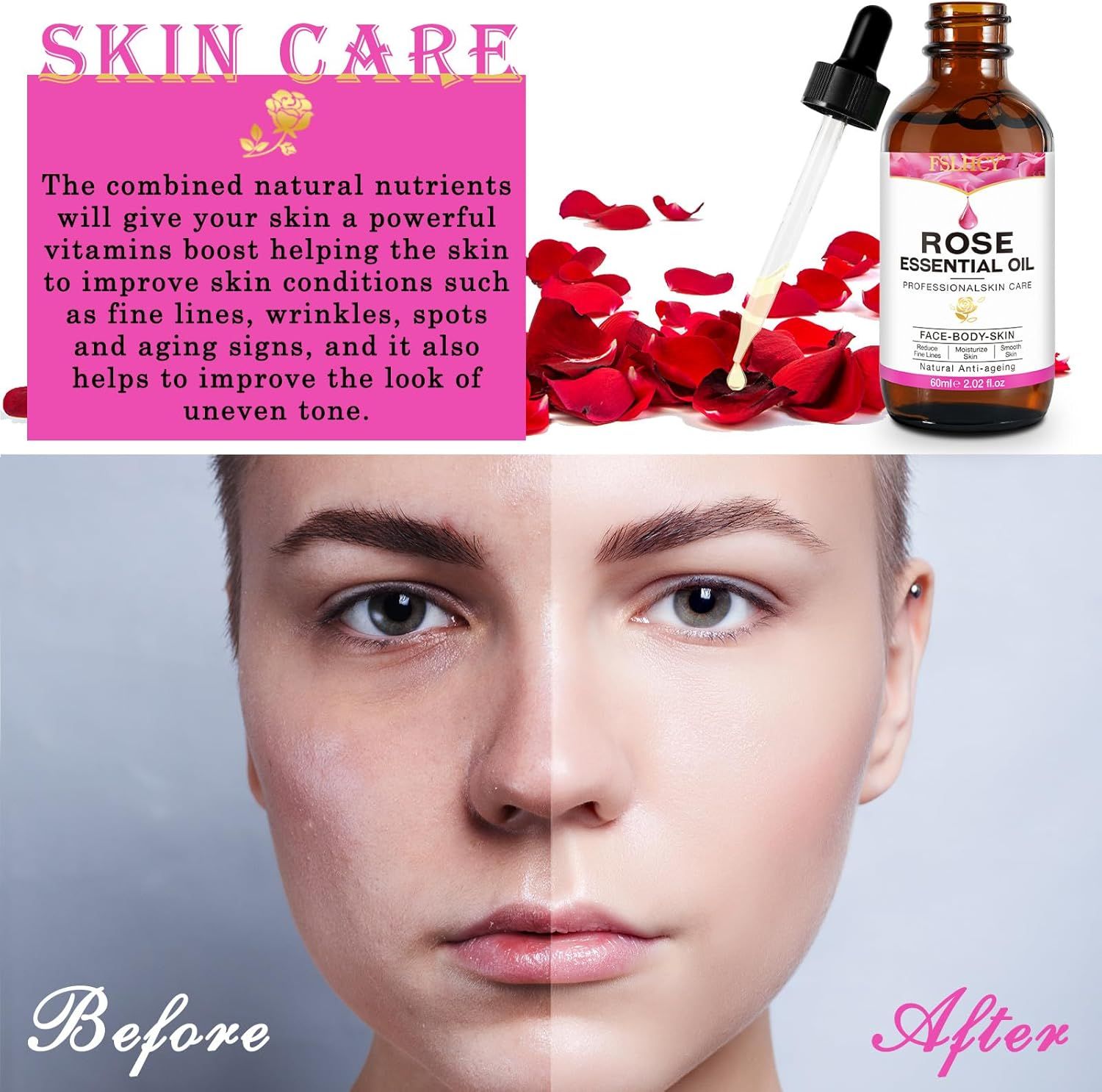 Flacone di vetro marrone con siero e contagocce. Scritta: Rose Essential Oil. Immagine prima-dopo della pelle.