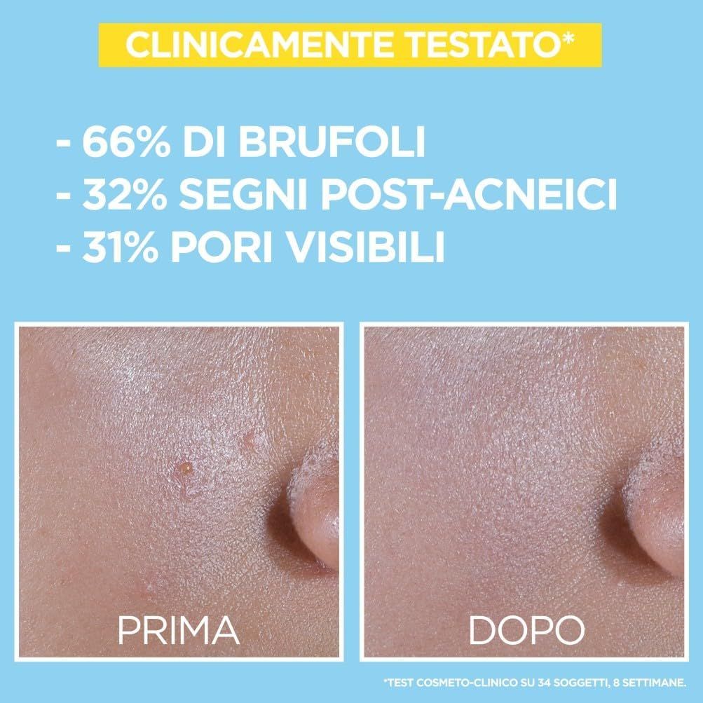Garnier Hautklar BHA + Niacinamide Daily UV. Confronto prima-dopo. Testo: -66% brufoli, -32% segni, -31% pori.