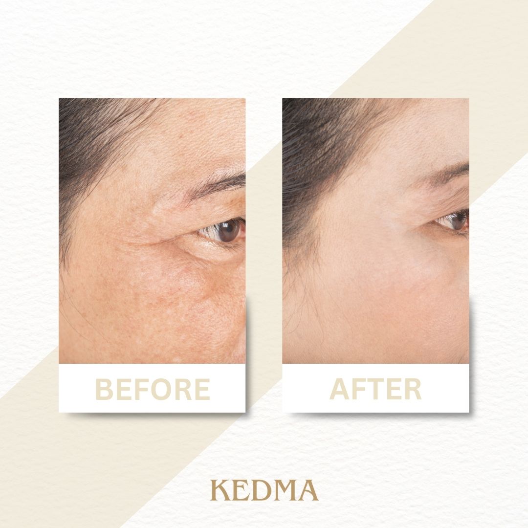 Kedma - Siero Giorno Elixir con Acido Ialuronico e Vitamine