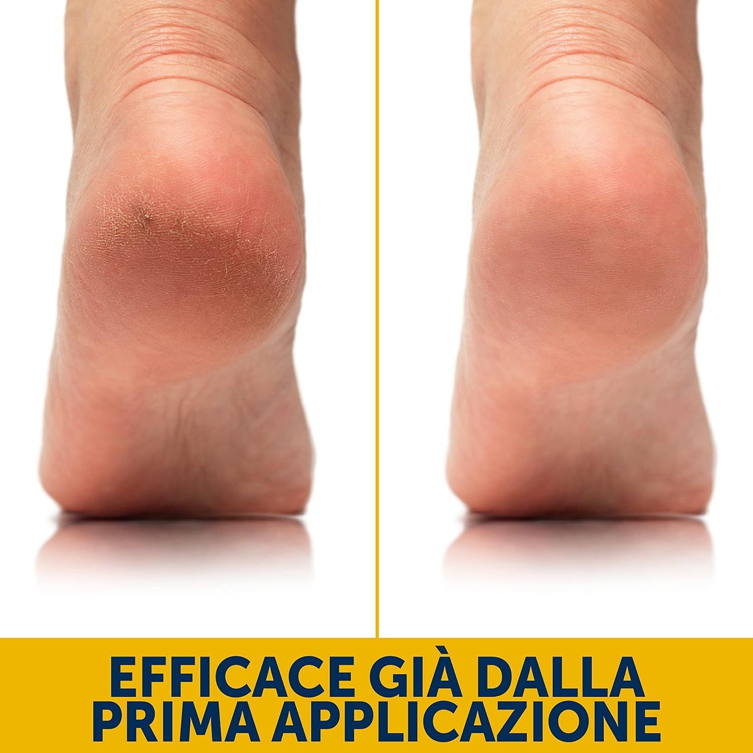 Podovis Crema Pomice 100 ml - Azione esfoliante e levigante per piedi