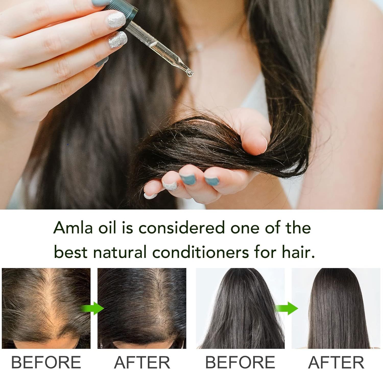 Zoxpm Olio per Capelli Amla