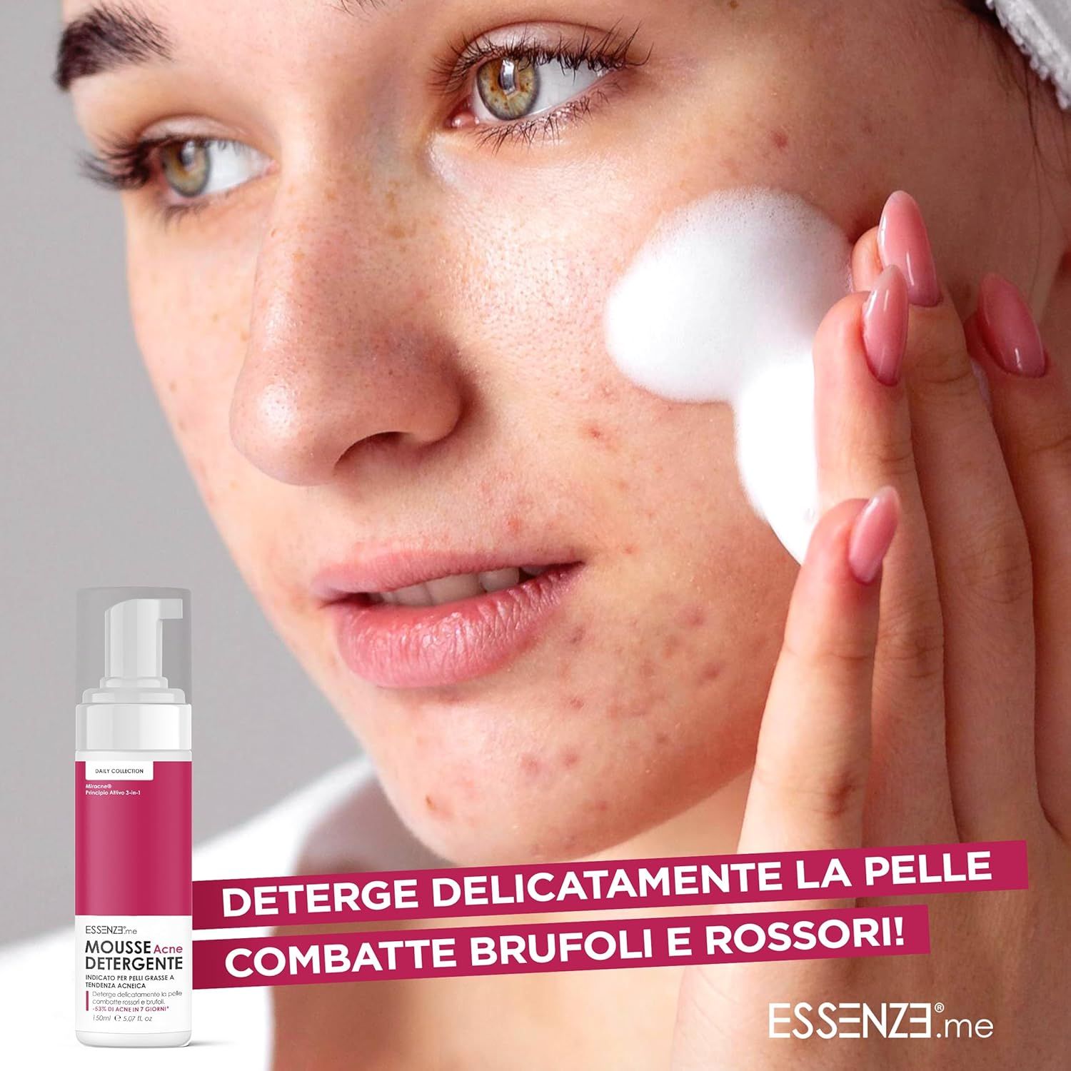 Essenze.me Mousse Detergente Viso Anti Acne per Pelle Grassa, Mista, a Tendenza Acneica - 150 ml