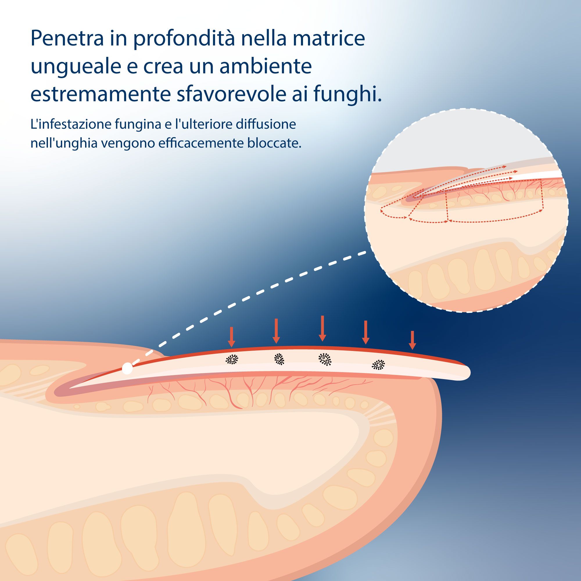 Liquido anti micosi delle unghie - per i funghi delle unghie di mani e piedi