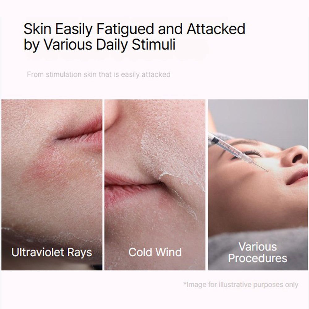 Tre immagini mostrano danni alla pelle da raggi UV, vento freddo e procedure. Testo: Skin Easily Fatigued.