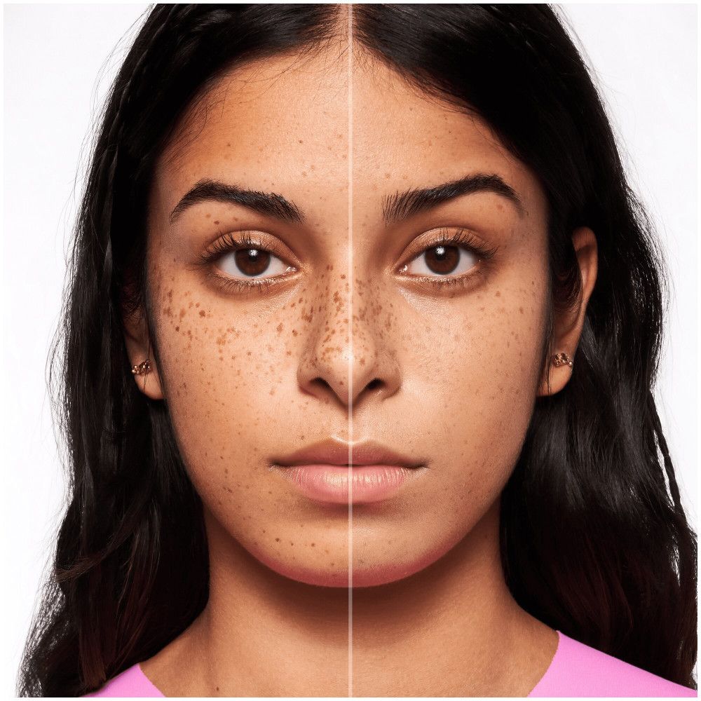 Viso diviso. Un lato con imperfezioni, l'altro uniforme. Confronto.