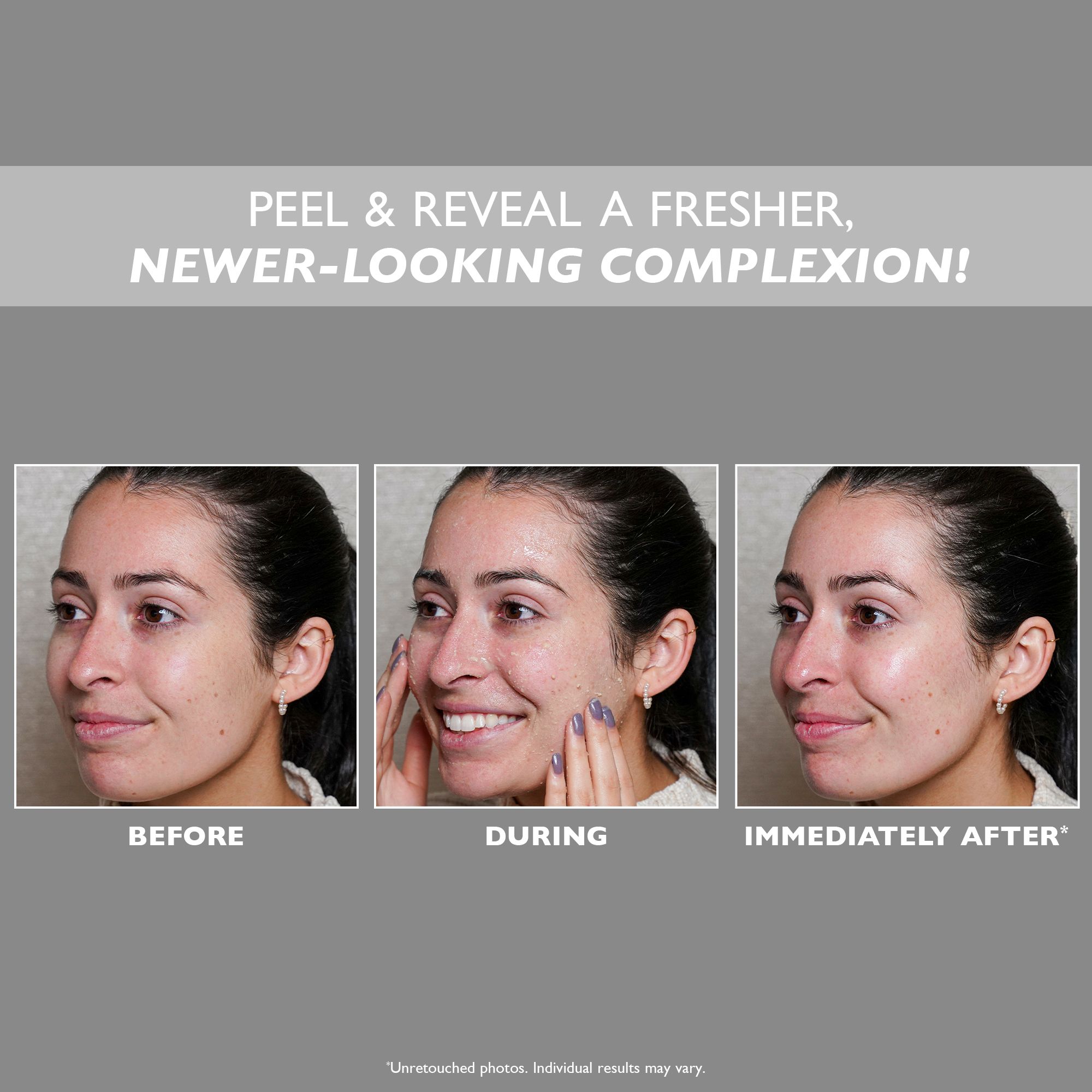 Tre foto: Prima, Durante, Subito dopo. Testo: PEEL & REVEAL A FRISHER, NEWER-LOOKING COMPLEXION! Donna con imperfezioni, espressione cambia.