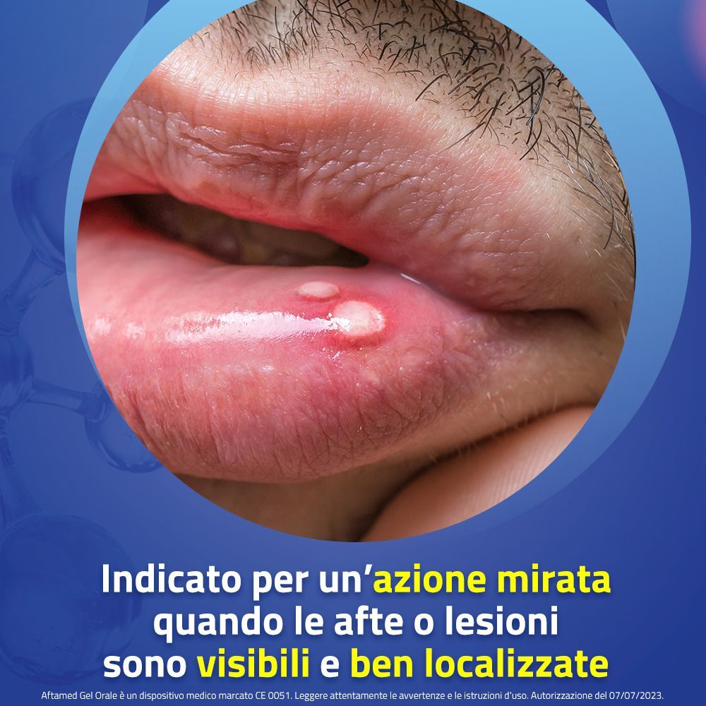 Bracco Aftamed® Gel Orale