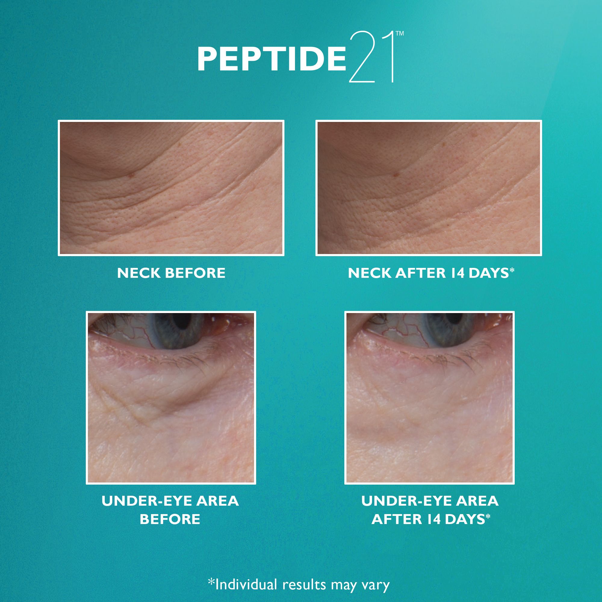 Immagini prima e dopo del collo e del contorno occhi. Testo: PEPTIDE 21.