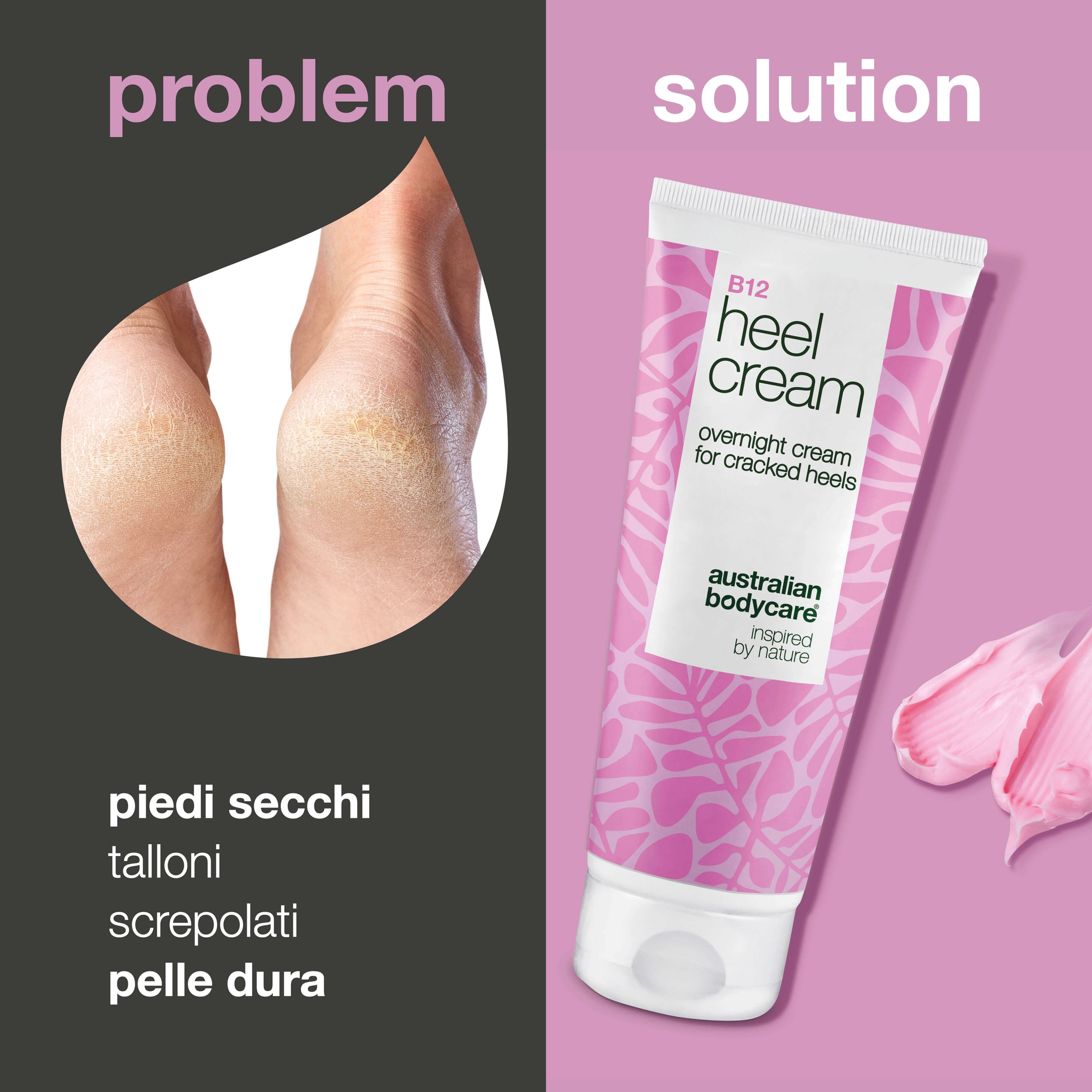 Piedi con talloni secchi. A destra: tubo B12 Heel Cream. Macchie di crema rosa. Testo: overnight cream for cracked heels.