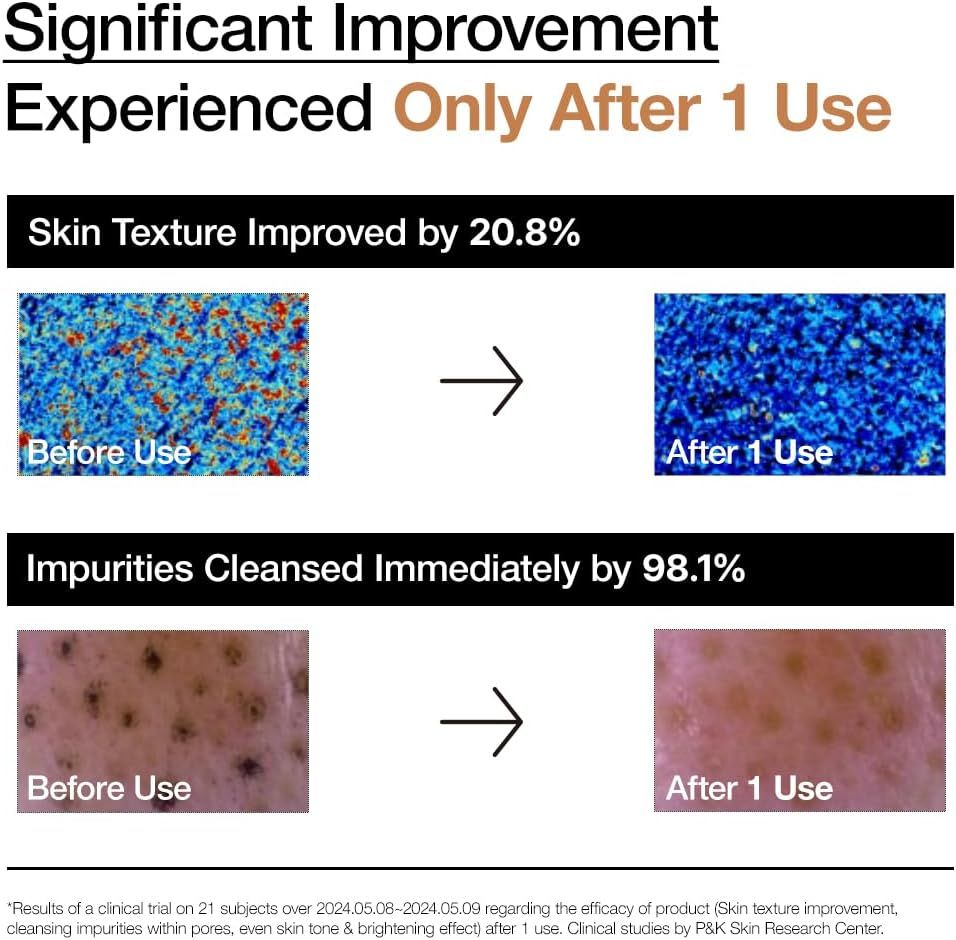 Confronto prima-dopo della texture della pelle e delle impurità. Testo: Significant Improvement Experienced Only After 1 Use.