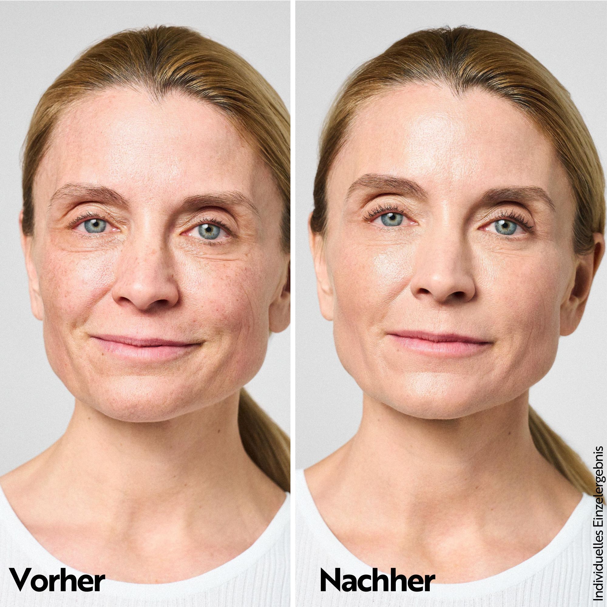 M. Asam AQUA INTENSE Mimic Booster