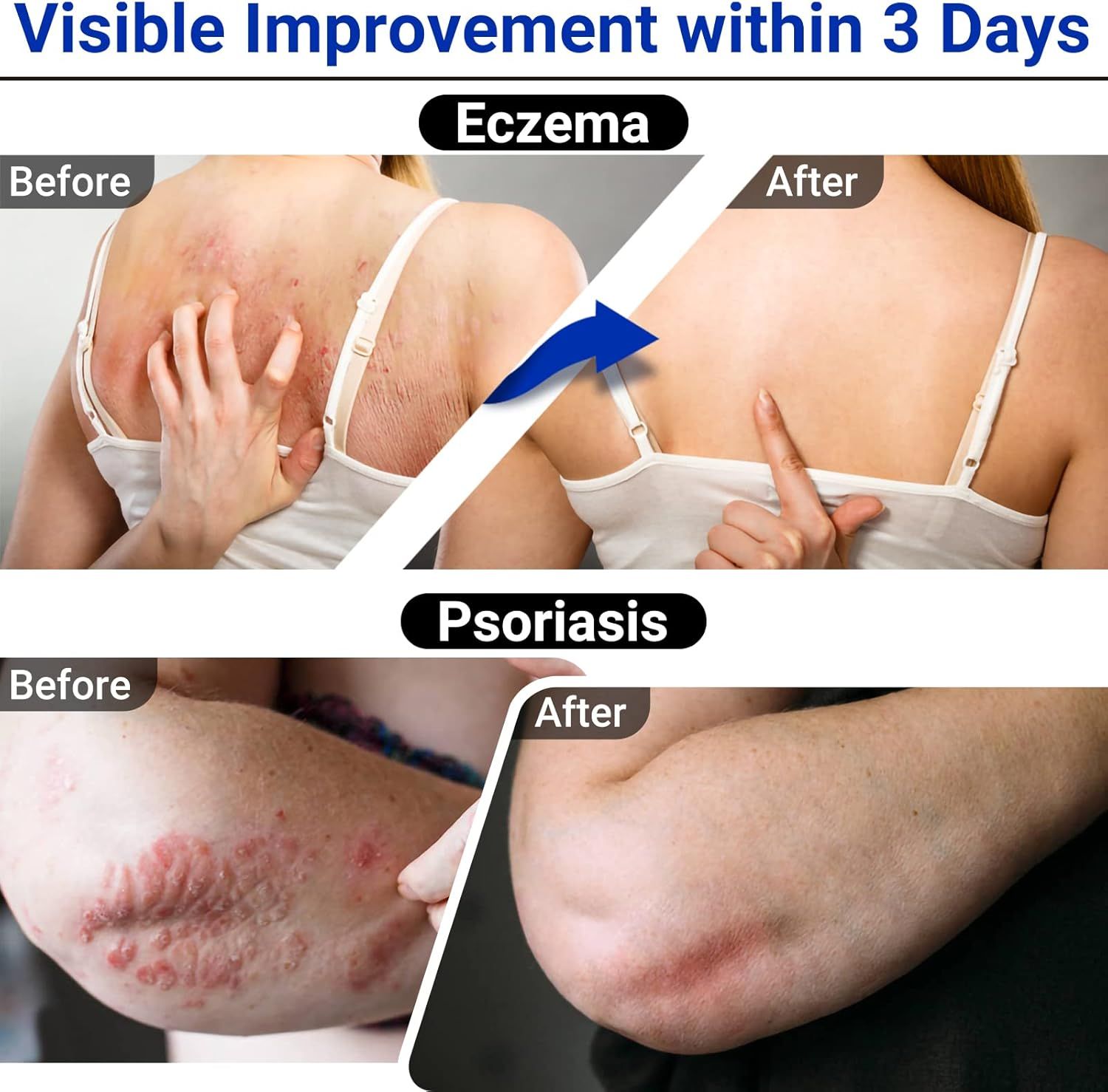 LMNOOP crema per eczema