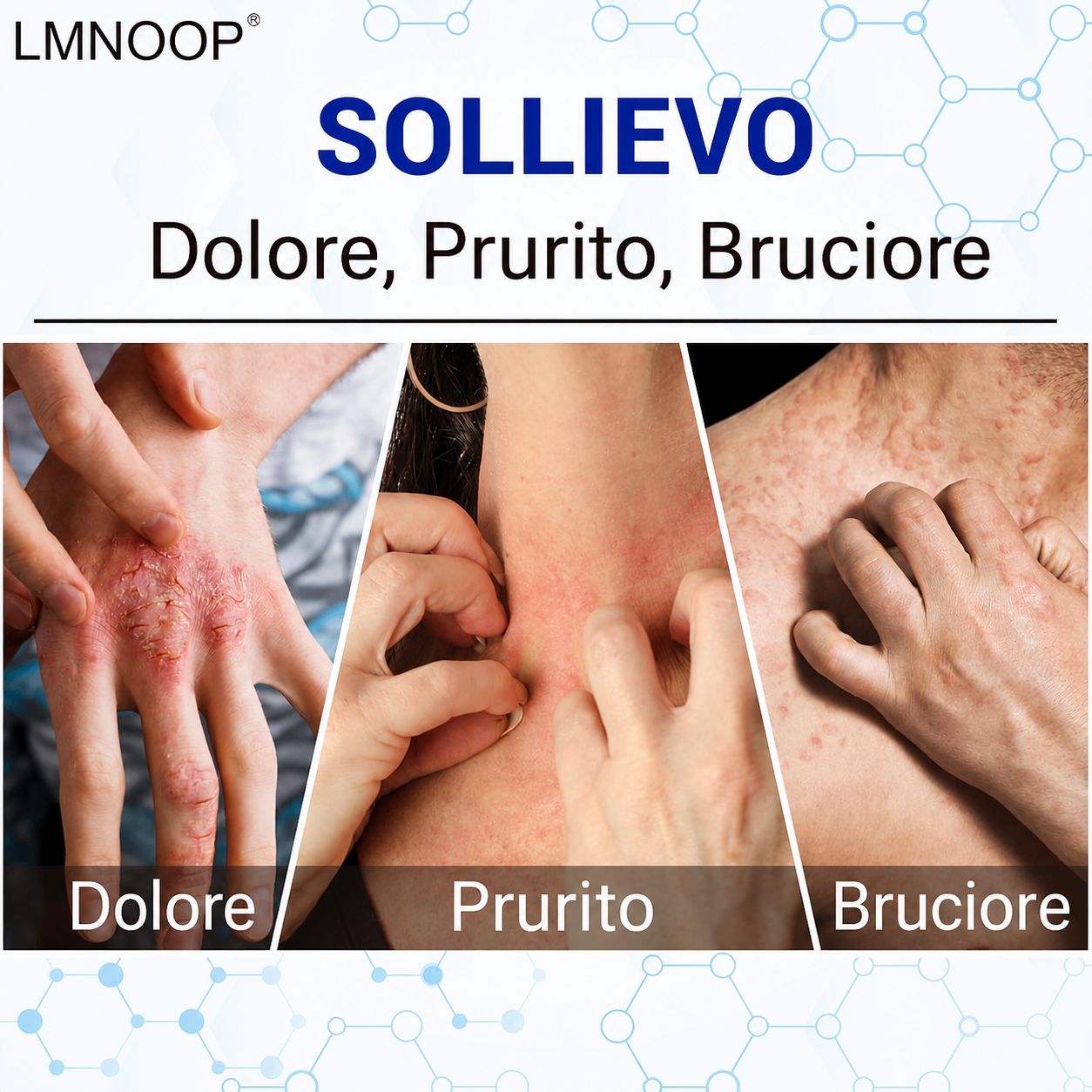 LMNOOP crema per eczema